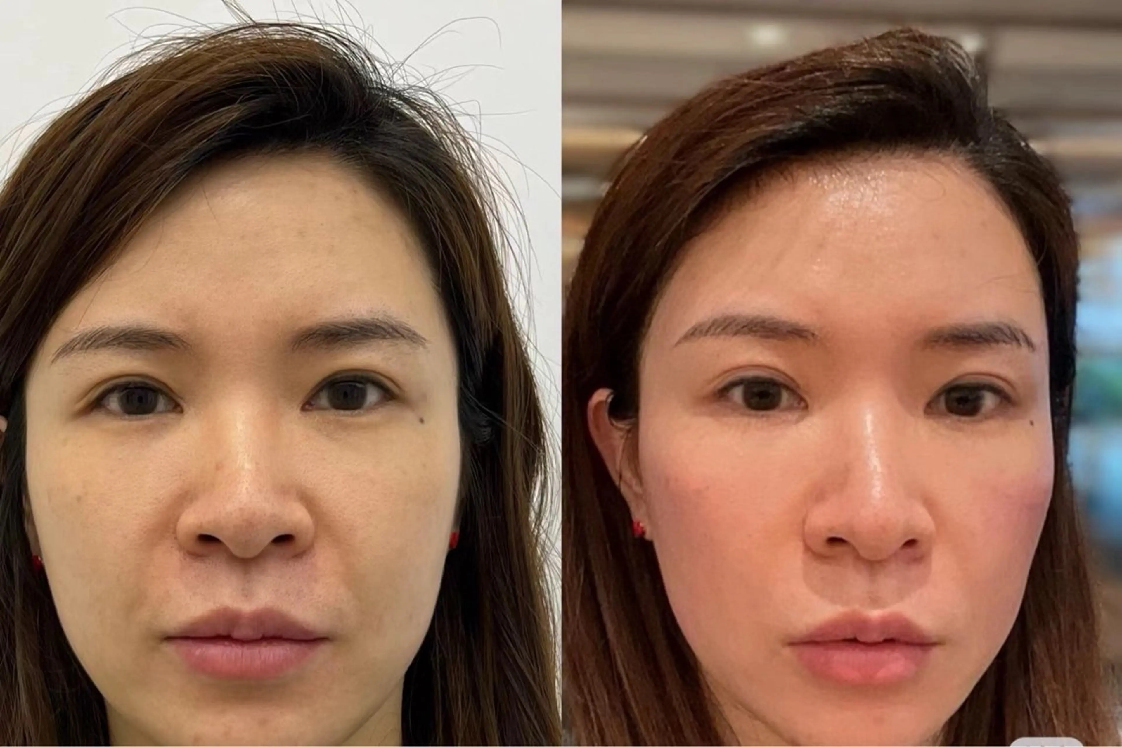 マツエク・マツパ 韓国風マツエク 結婚式・ブライダル エステ aliaハイフ&水光ジェットサロン所属・aliaハーブ水光店 エステティシャン募集のエステ・リラクイメージ