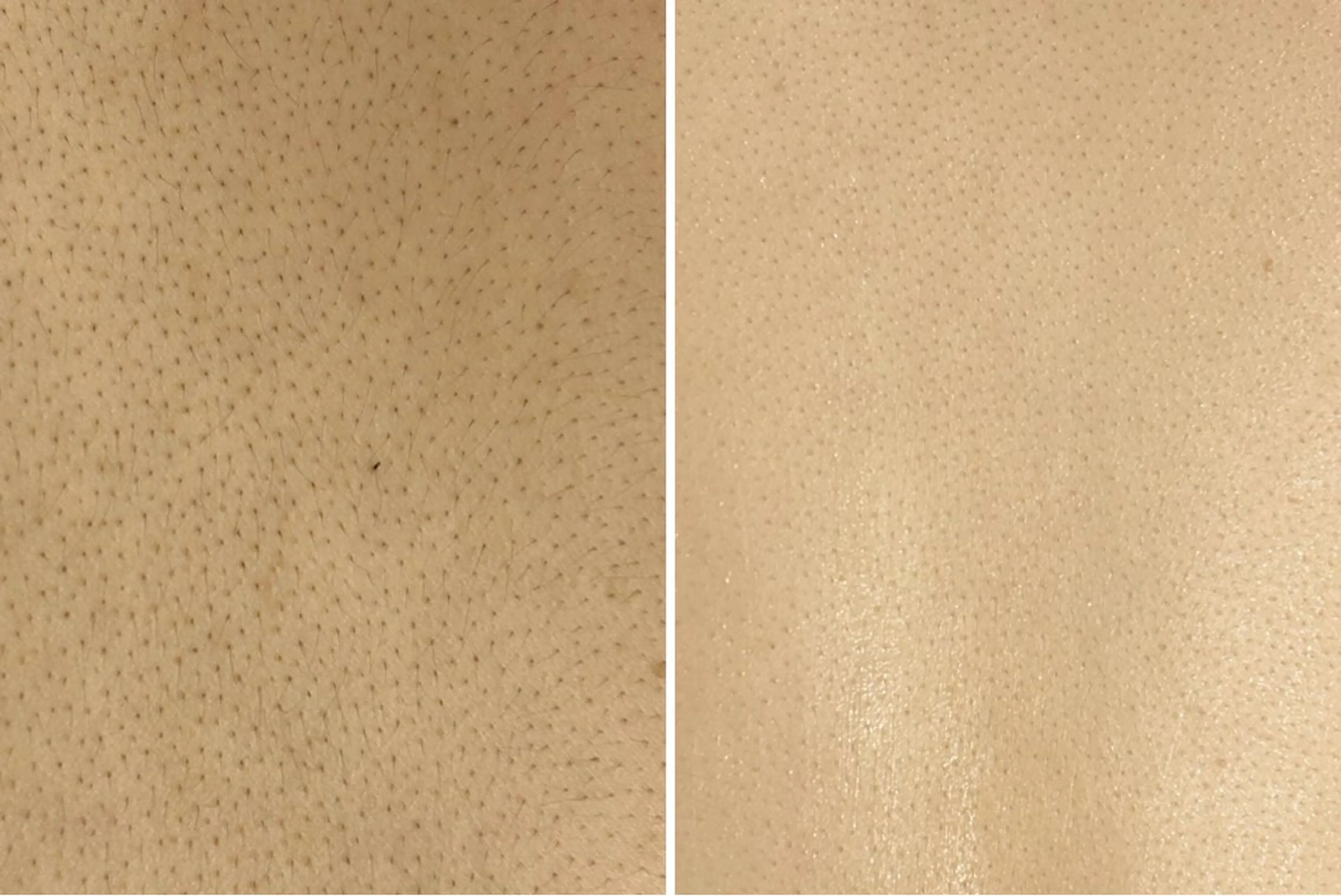 【都度払い脱毛 美肌脱毛】馬車道店のエステ・リラクイメージ