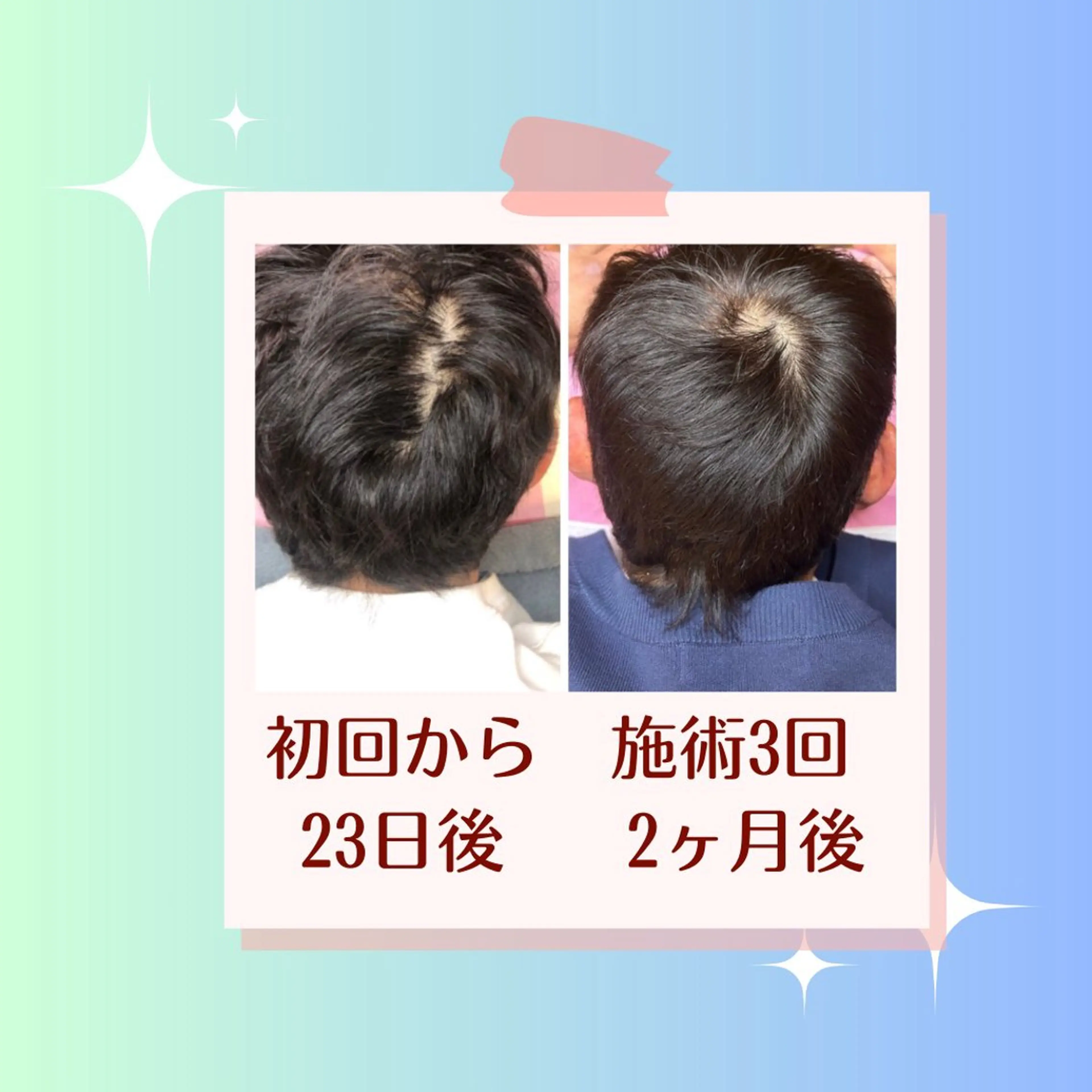 かすがい鍼灸院Re.heart所属・かすがい鍼灸院 Re.heartのエステ・リラクイメージ