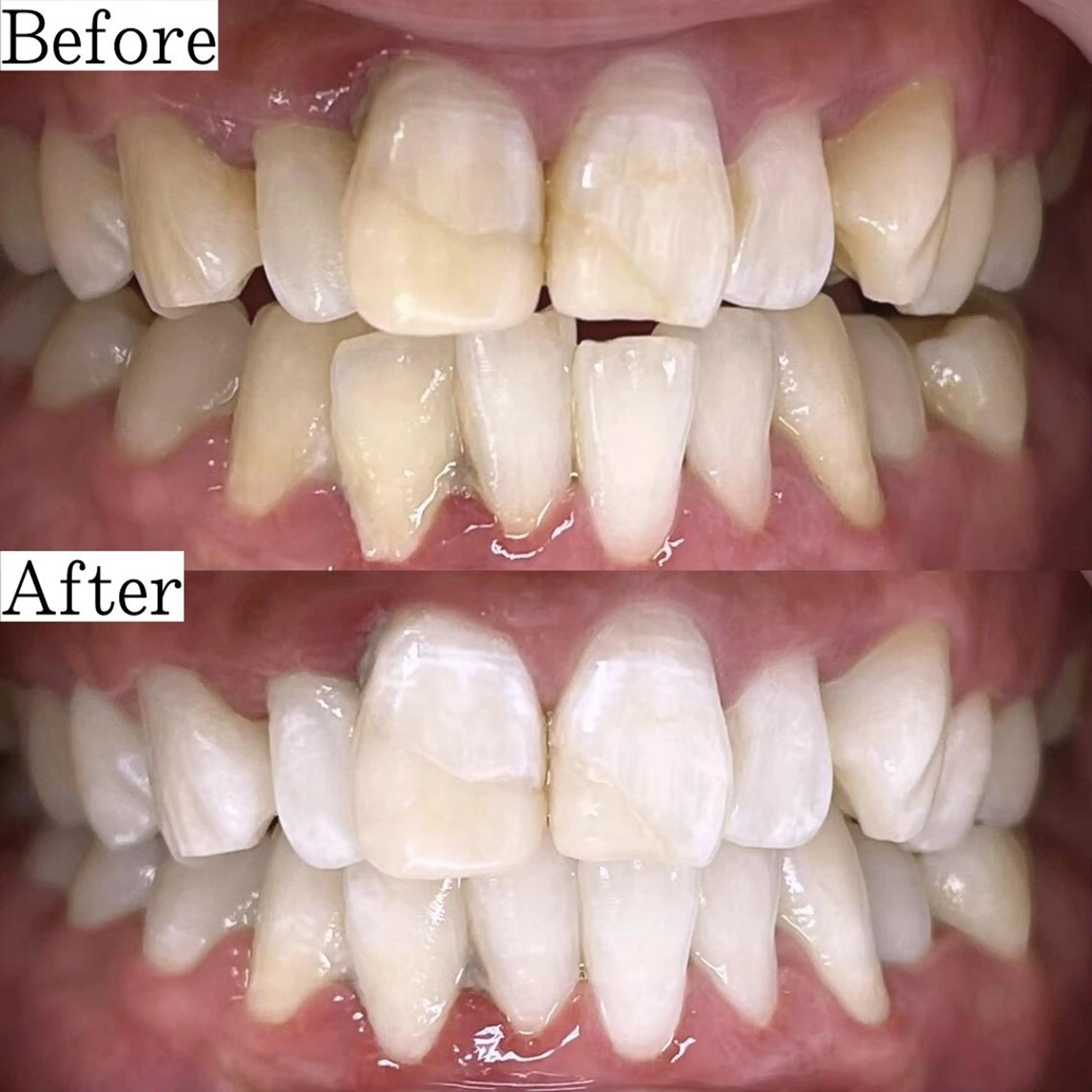 LBSホワイトニング 銀座店💎公式のその他イメージ