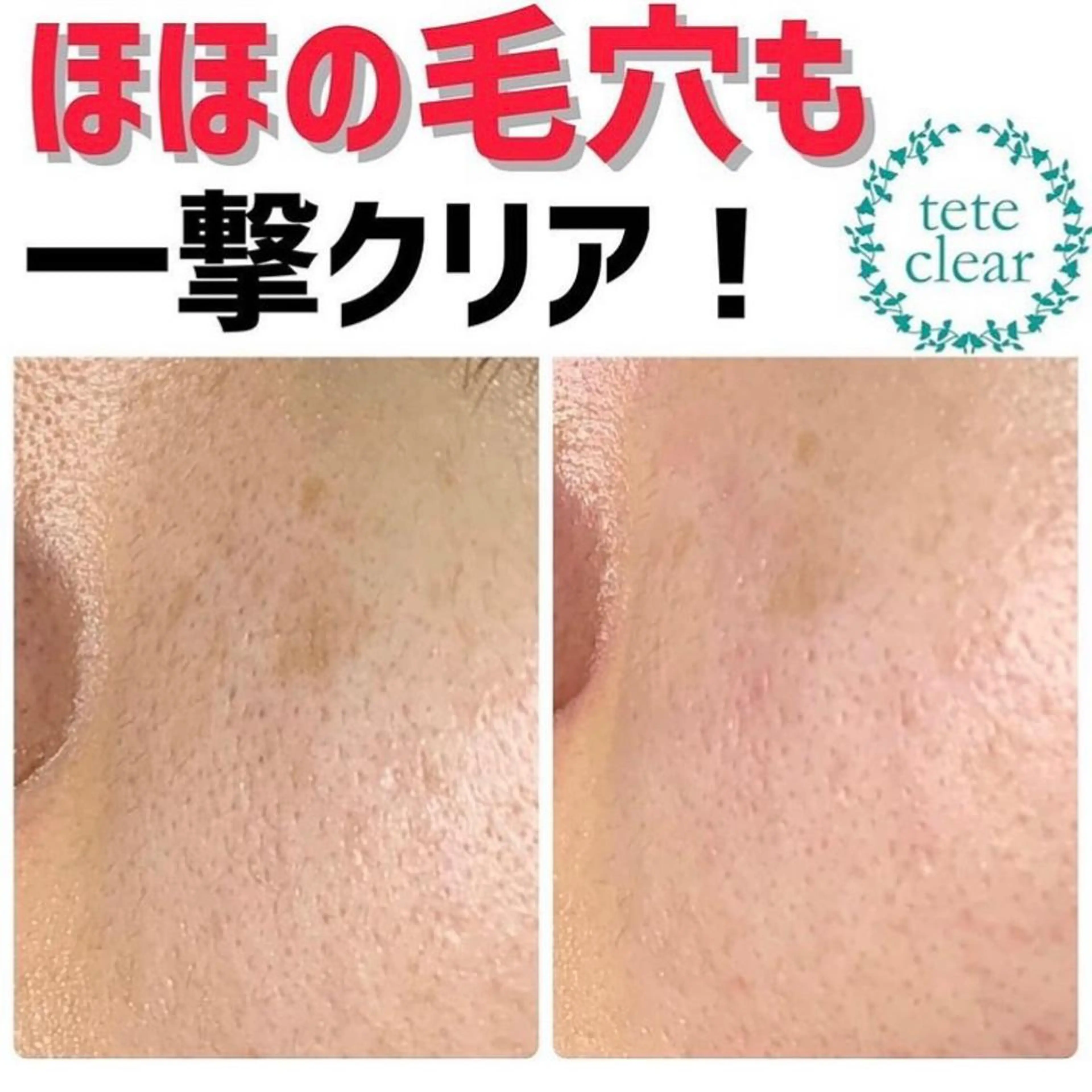 毛穴肌質ケアサロン Yourmeユアミーのエステ・リラクイメージ