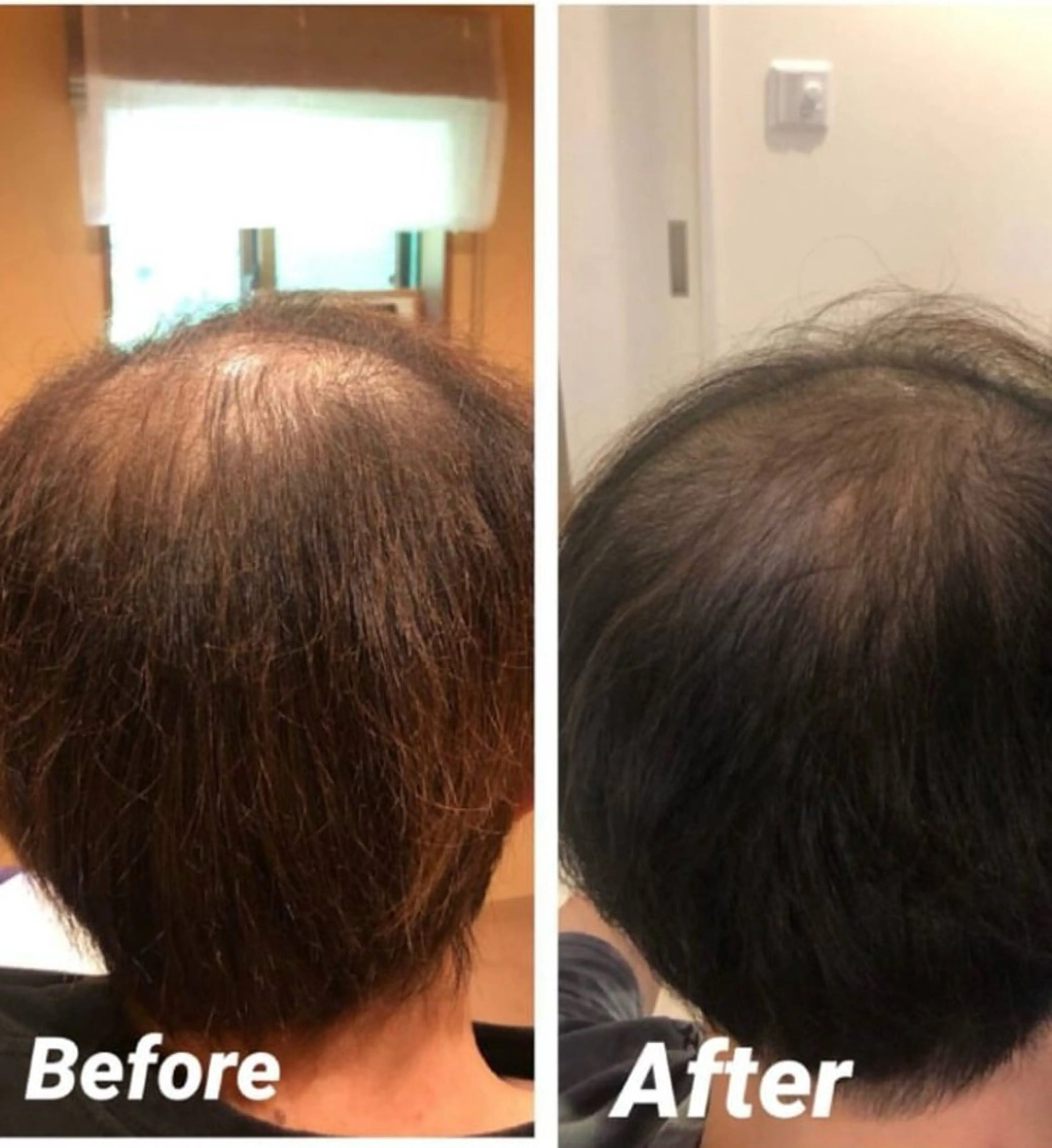 撮影モデル セレブリボーンパッシブタウン　プレミア所属・目澤 幸代のエステ・リラクイメージ