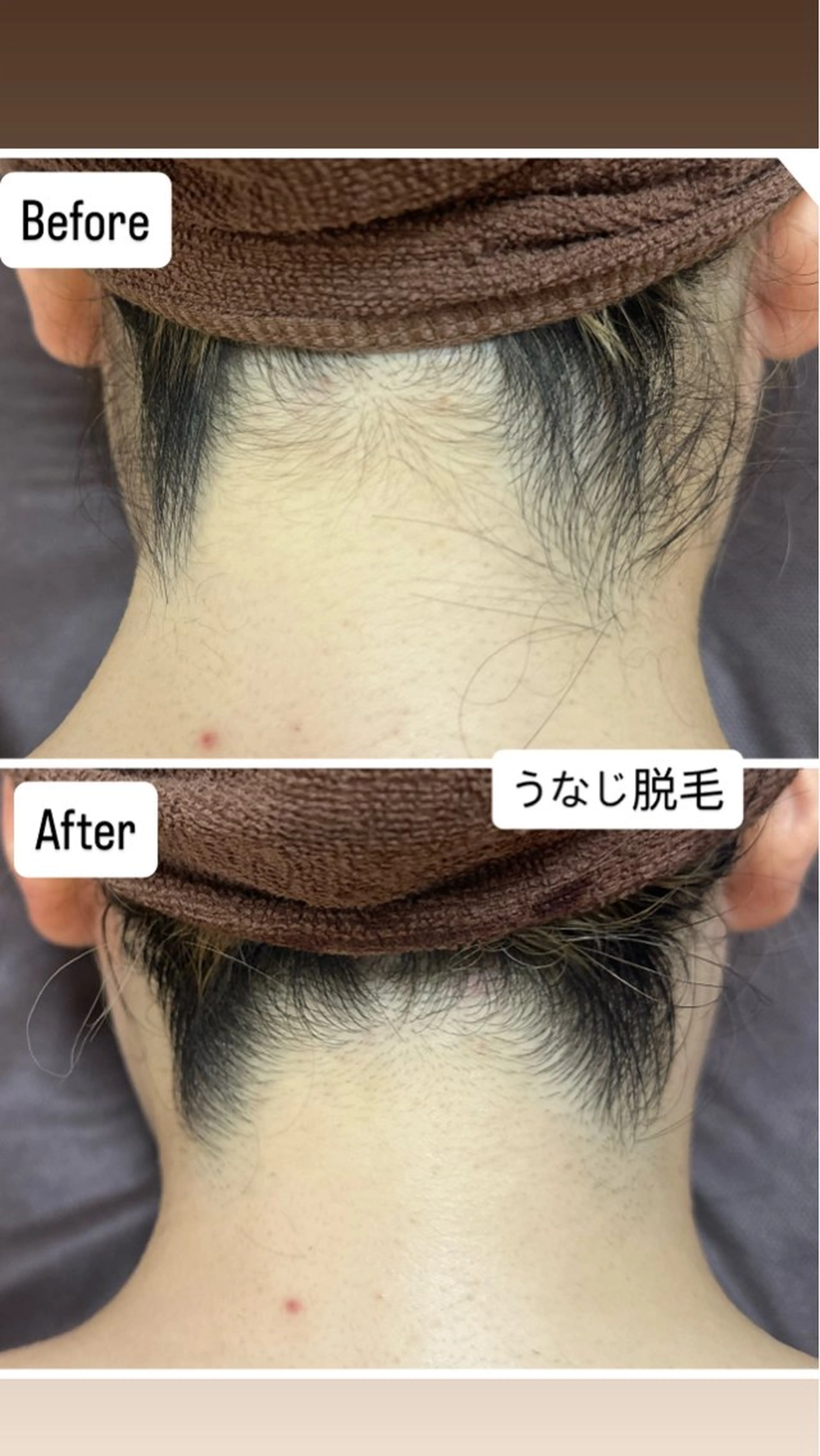 脱毛 桐山 まどかのエステ・リラクイメージ