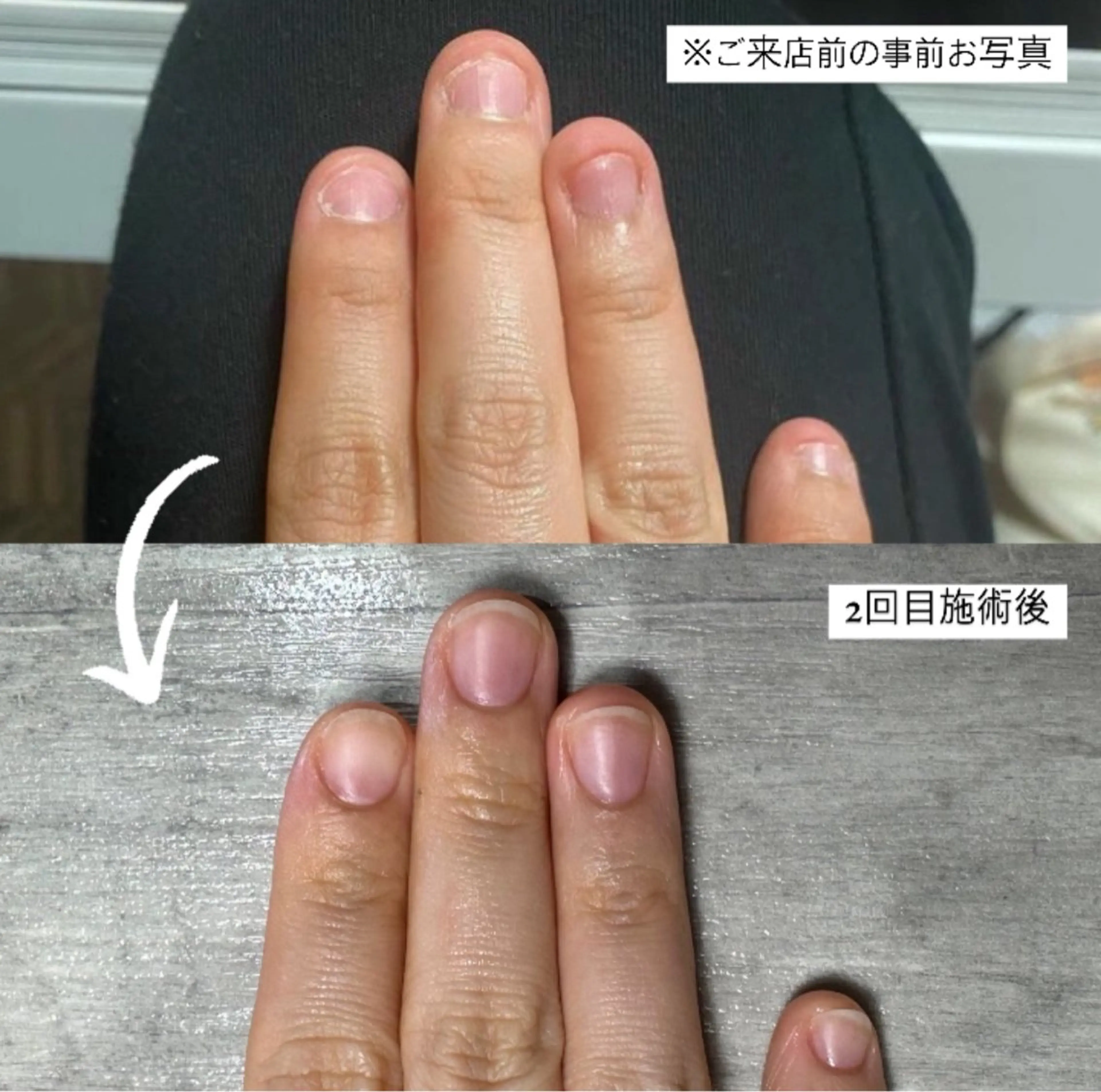 ネイル etoi所属・elmu (エルミュ)　本杉望のネイルデザイン