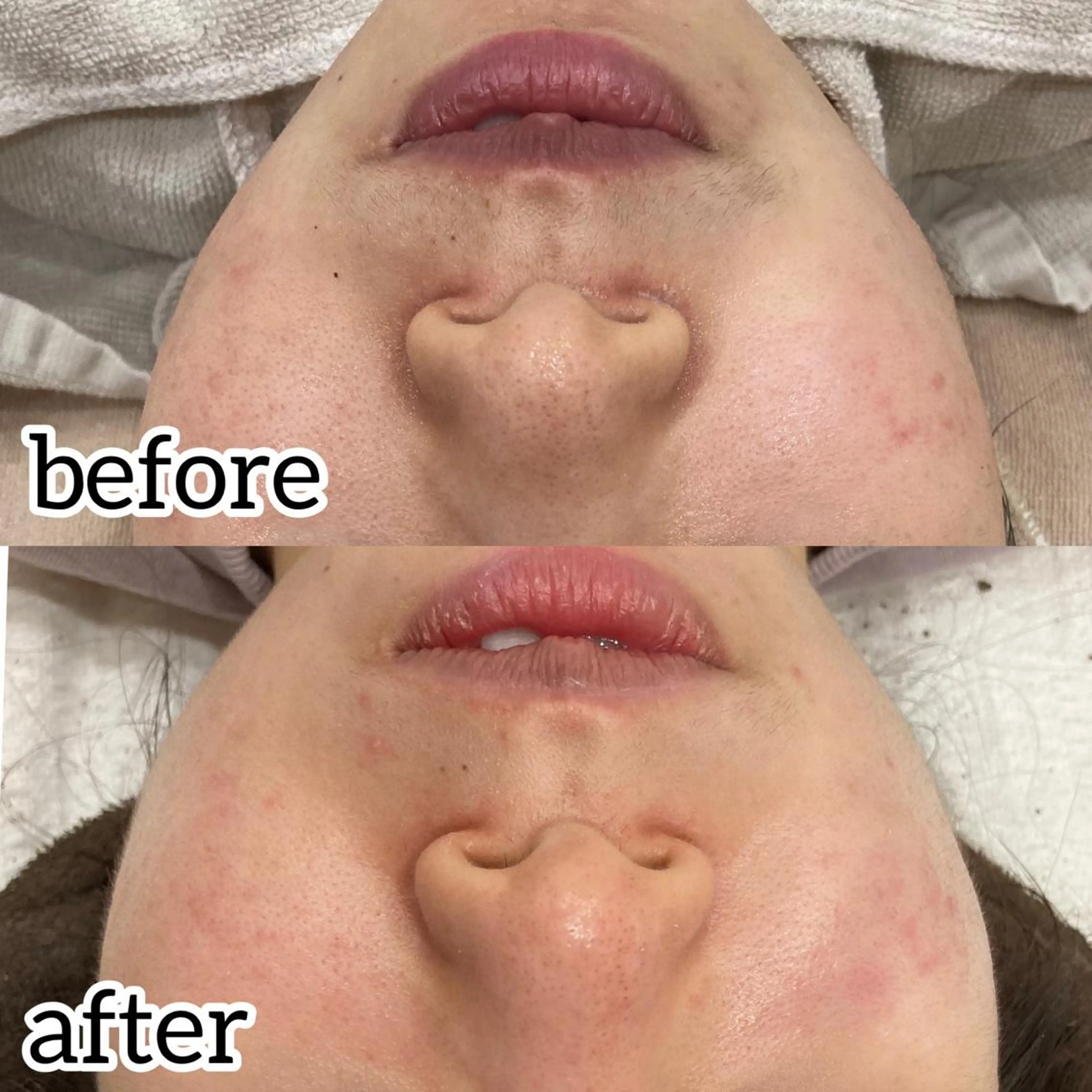 laluna saki...のその他イメージ