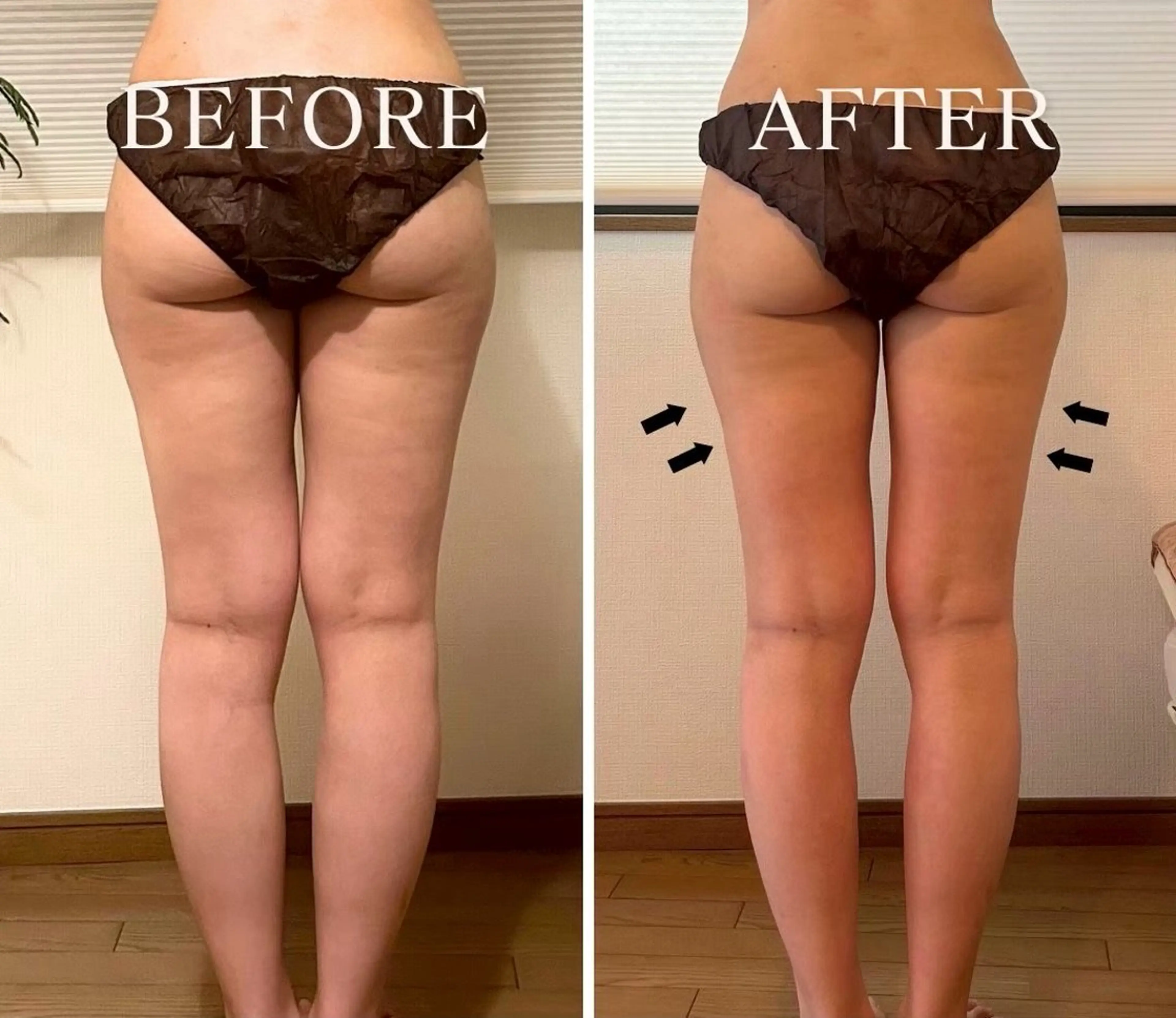 【美脚コース】¥7800→¥6800     リンパマッサージ10分/水素フットバス10分/よもぎ蒸し60分　100分の写真