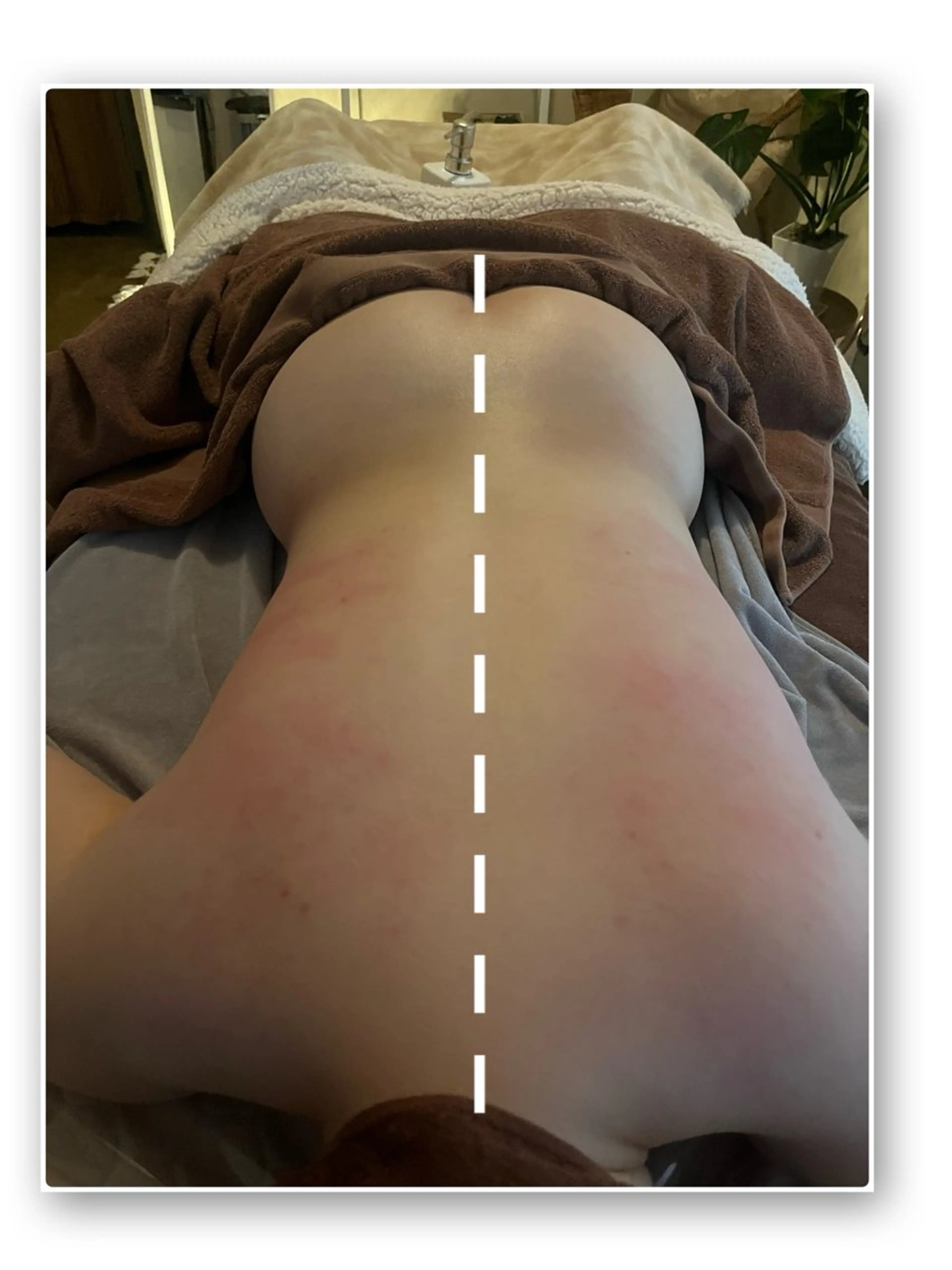 バストアップ・痩身 脱毛/🌺コオリナのエステ・リラクイメージ