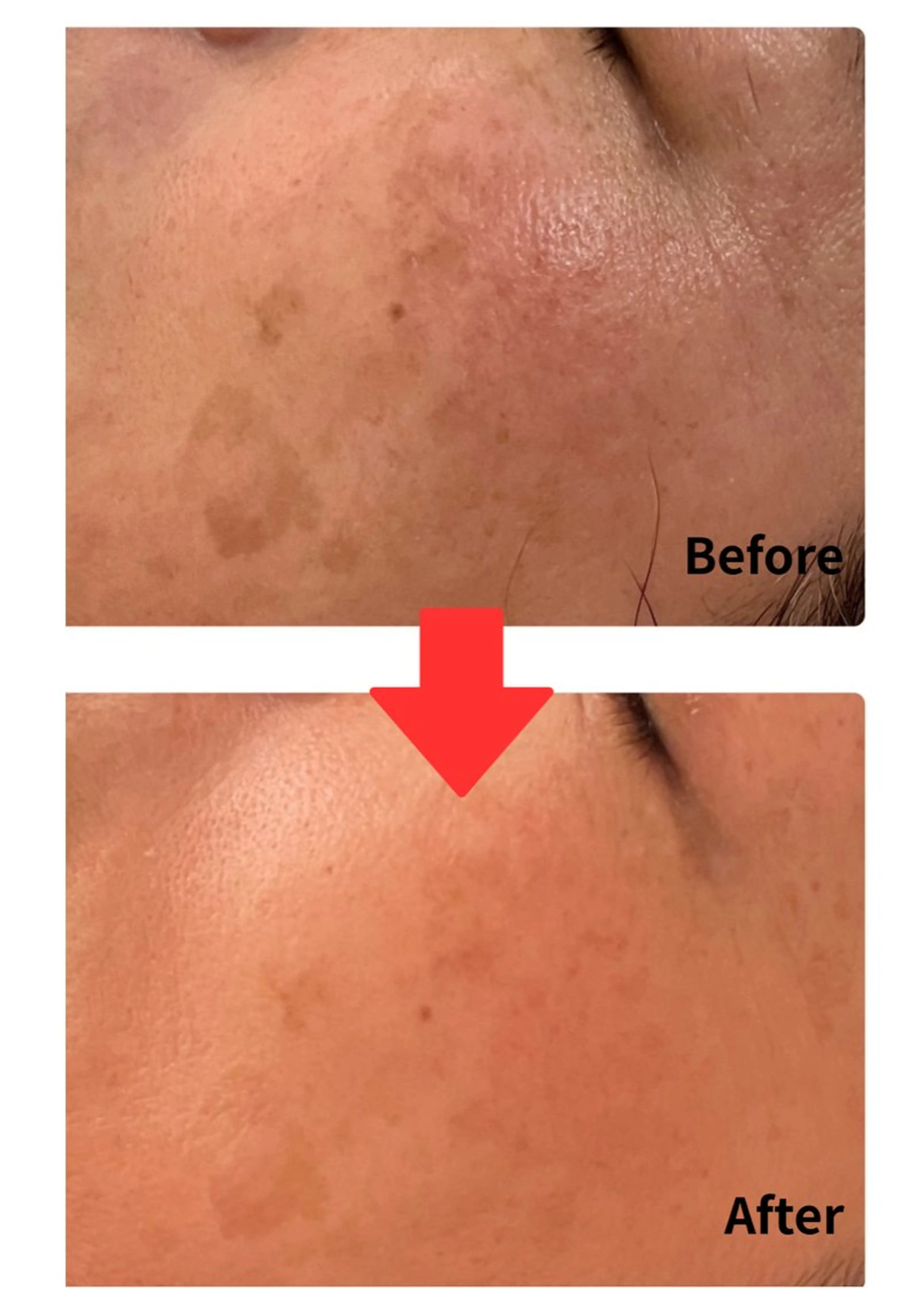 Belle White所属・本格痩身＊肌質改善＊ BelleWhiteのエステ・リラクイメージ