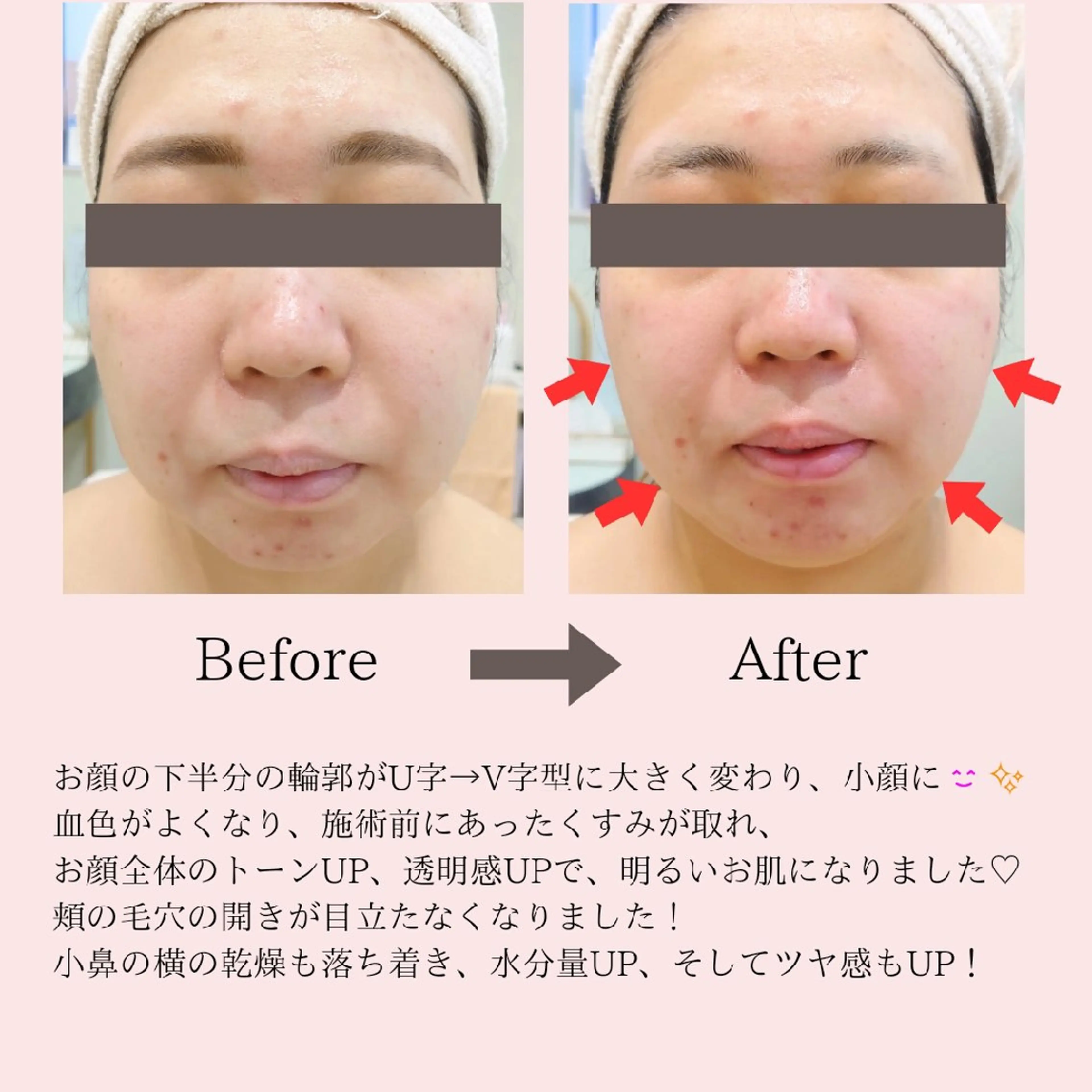 エステ PRETTIEST SHINE所属・フェイシャル/ボディ /ブライダル山田浩子のエステ・リラクイメージ