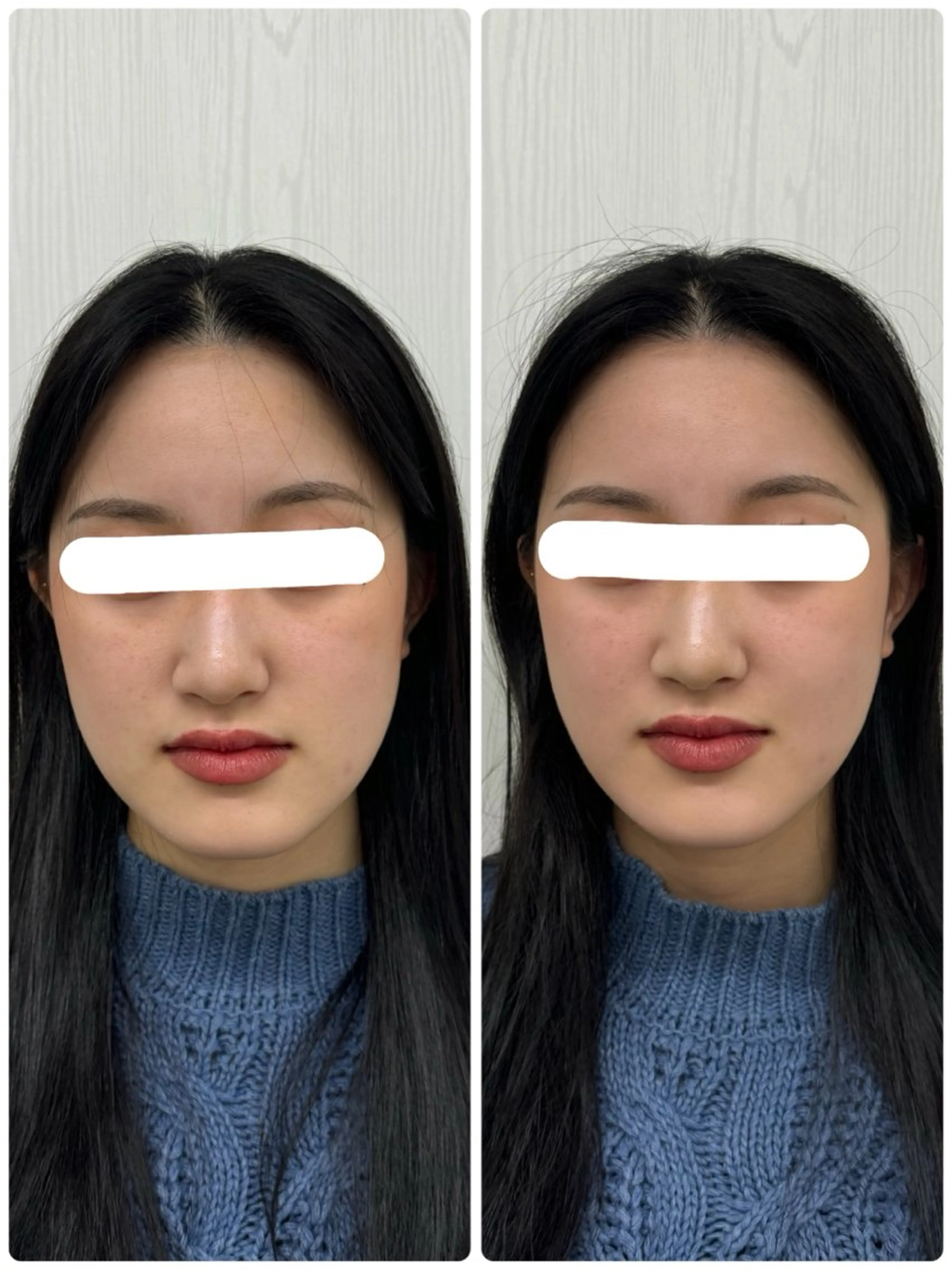 美容鍼×小顔矯正 ×美容整体　浜川泰仁のエステ・リラクイメージ