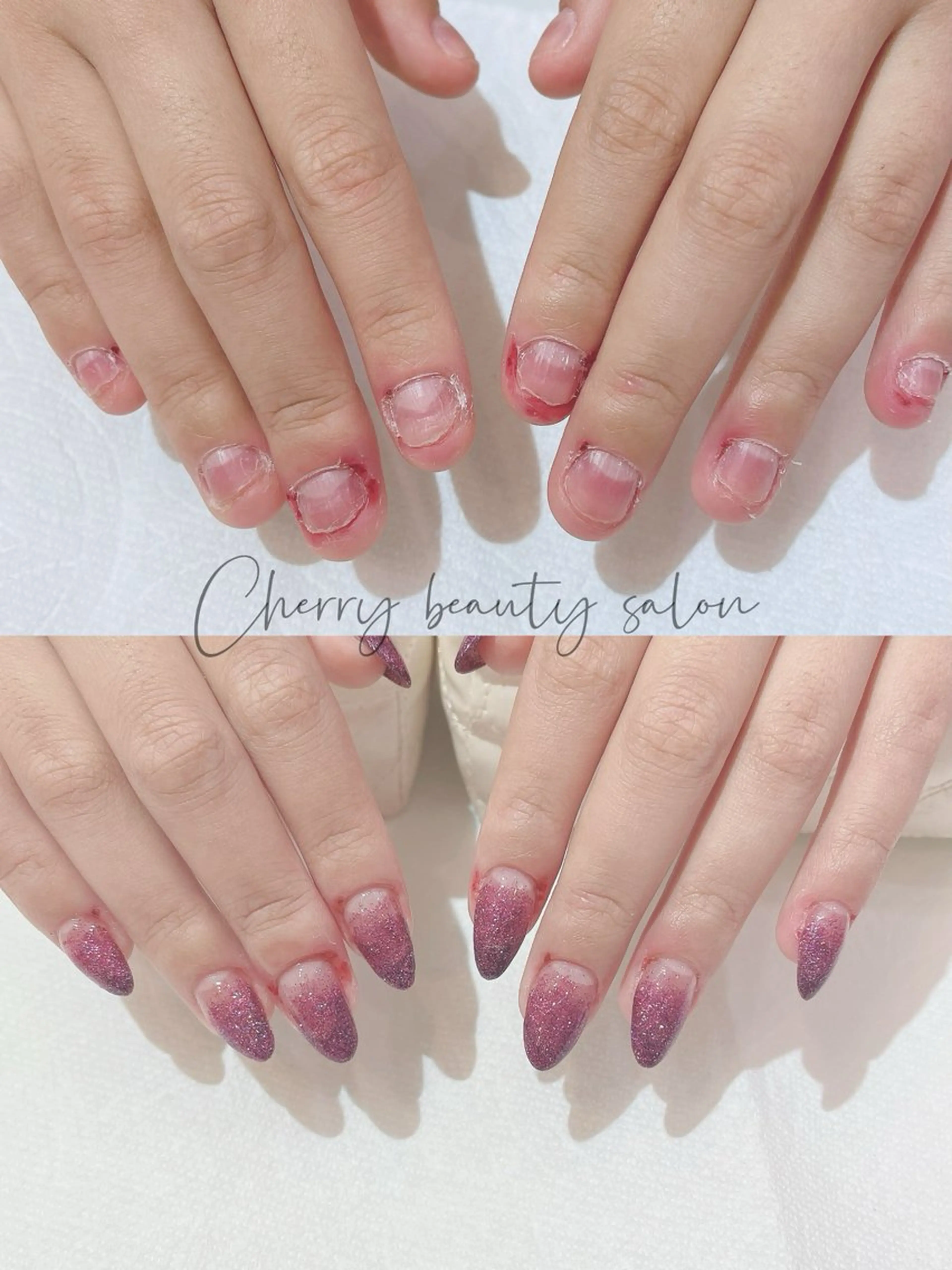 【爪噛み、深爪スカルプ長さだし】ワンカラー、ラメグラテーションの写真