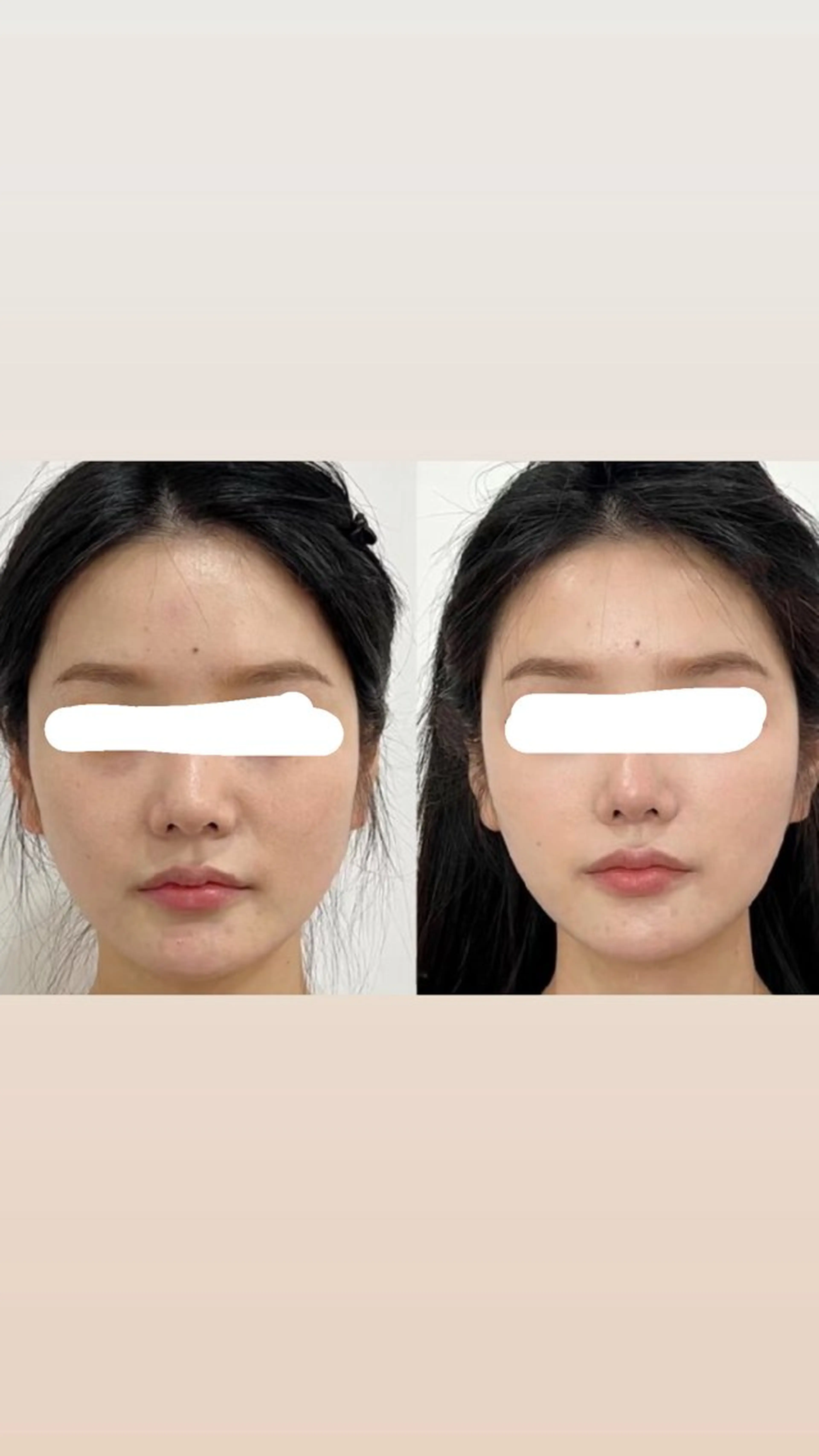 アイブロウ エステ リラク 愛維美水光美肌専門店所属・愛維美水光美肌専門店 メンズレディースokのエステ・リラクイメージ