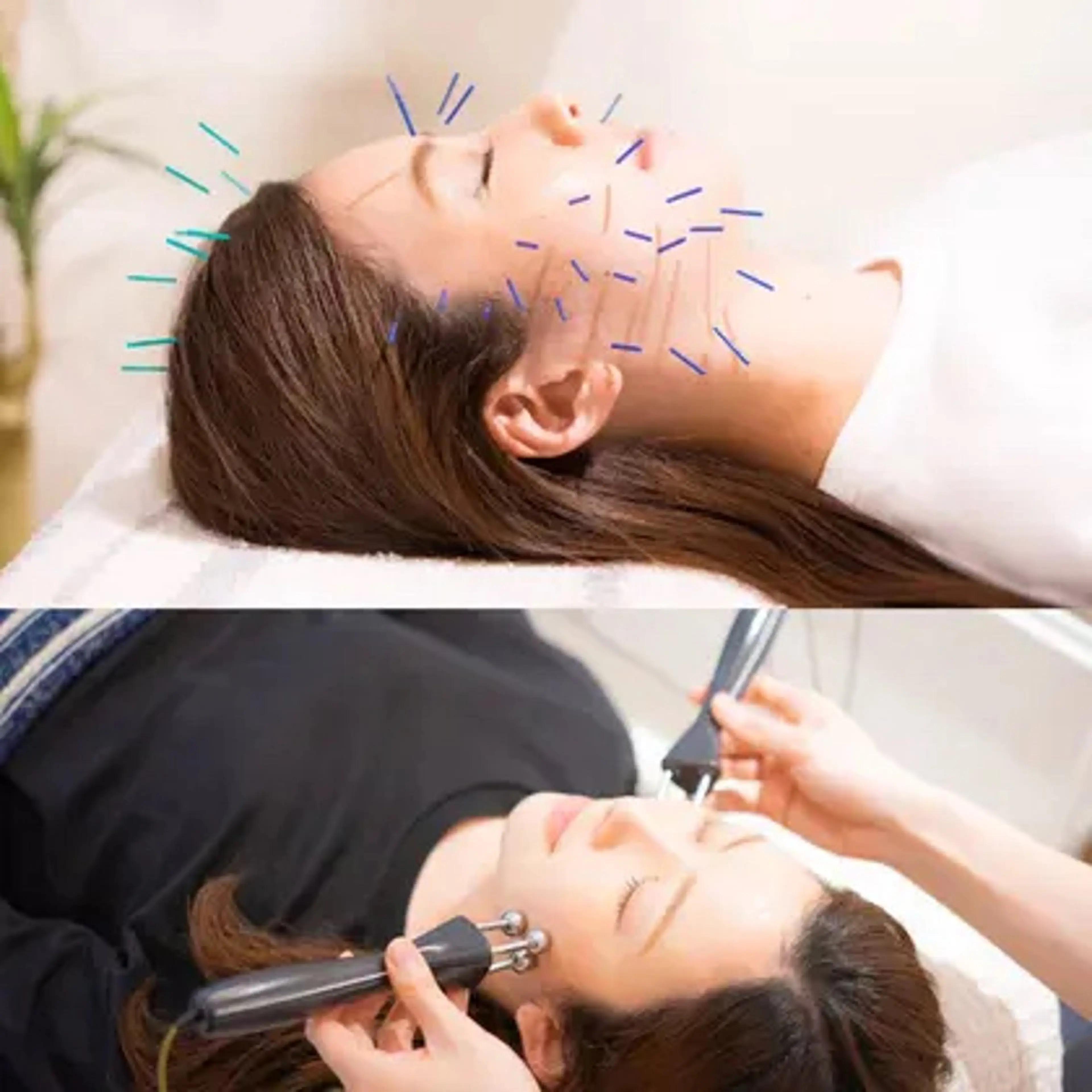 目黒/小顔/骨盤/ 美容鍼/美顔鍼/小林のエステ・リラクイメージ