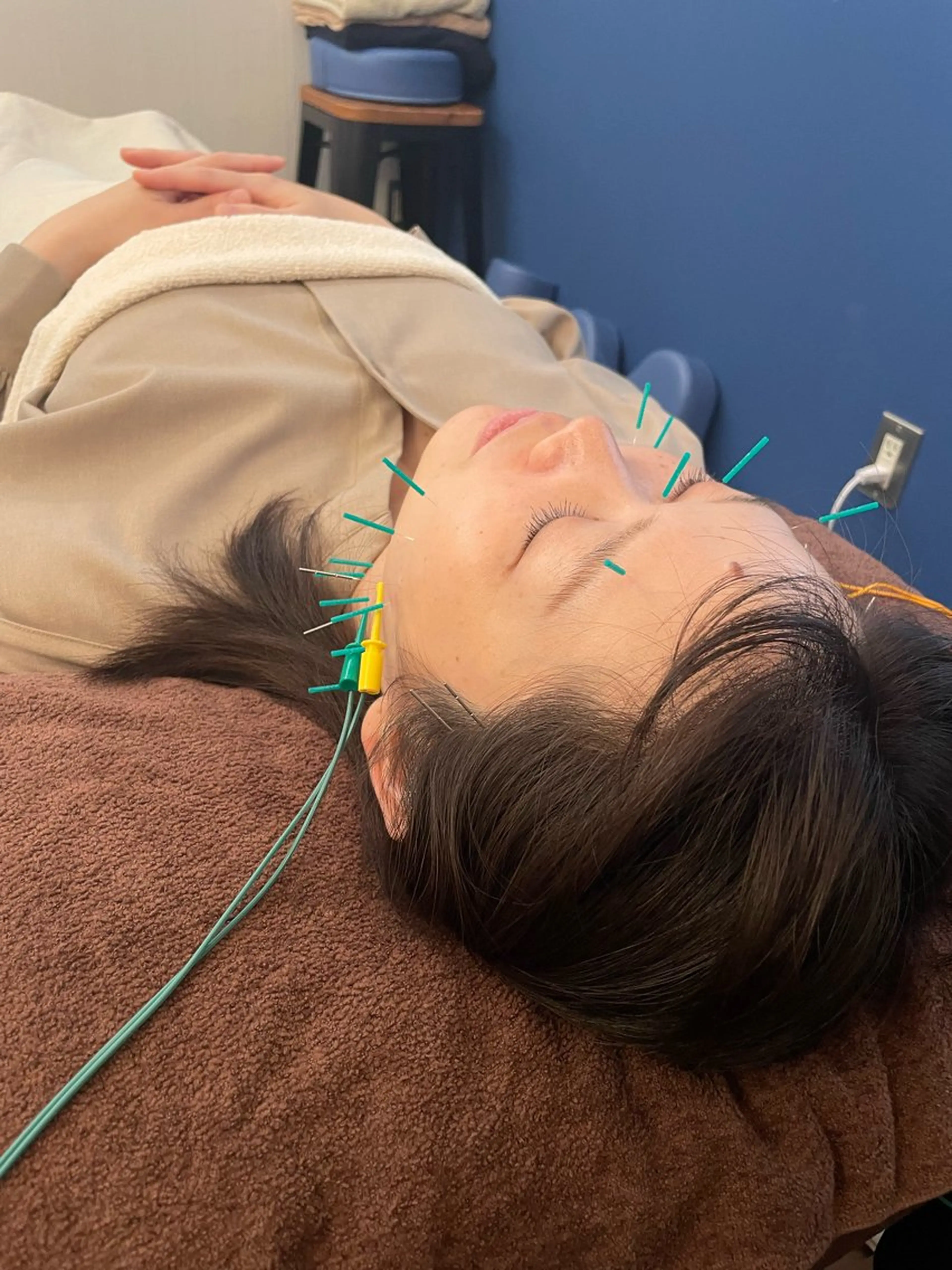 美容鍼　蒼月-aotsuki-所属・美容鍼「蒼月」 -アオツキ-のエステ・リラクイメージ