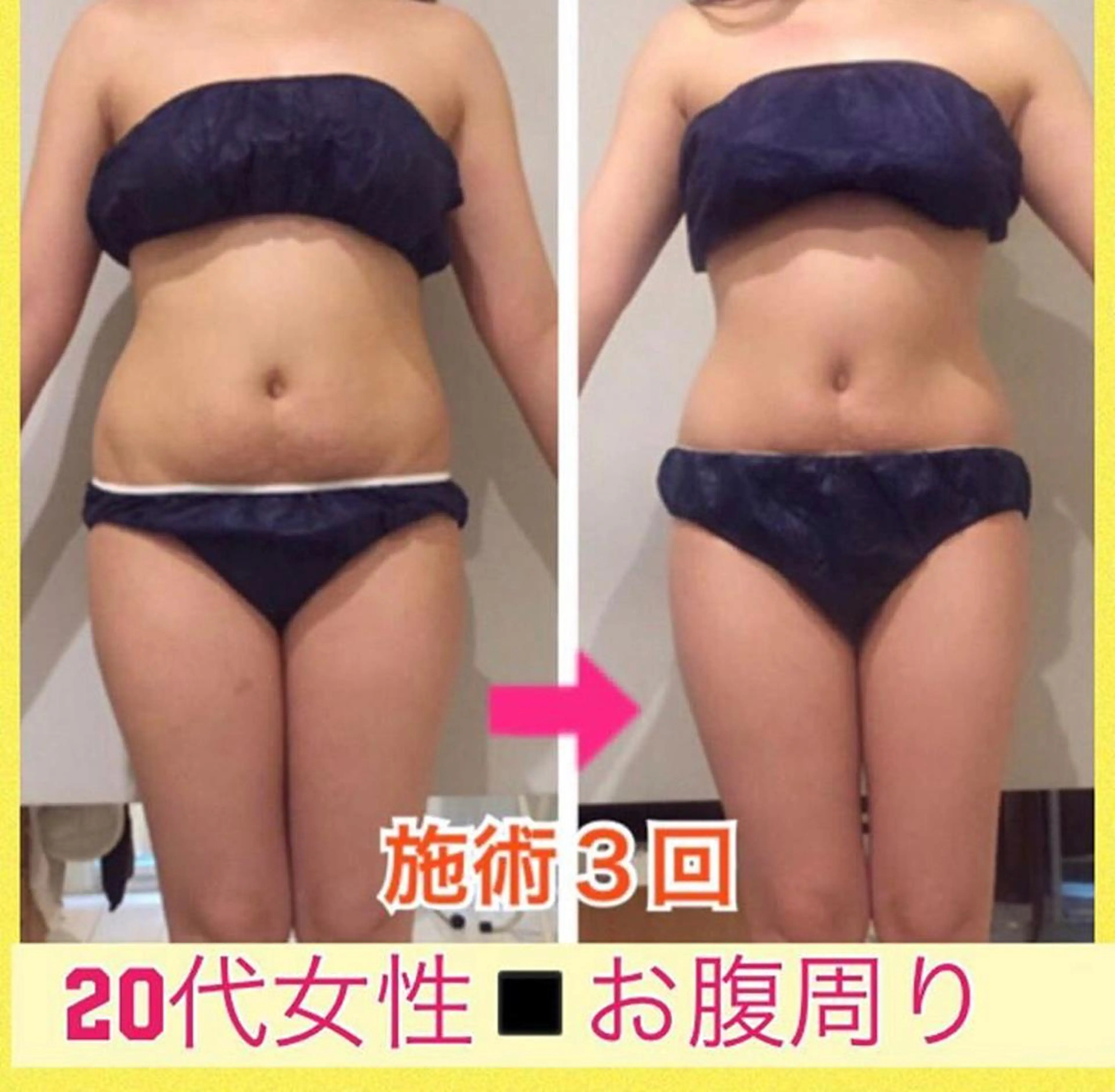 ロング カラー パーマ ヘアアレンジ メンズ キッズ ネイル マツエク・マツパ ‍痩身＆ボディ 結果出し🌟丹野のエステ・リラクイメージ