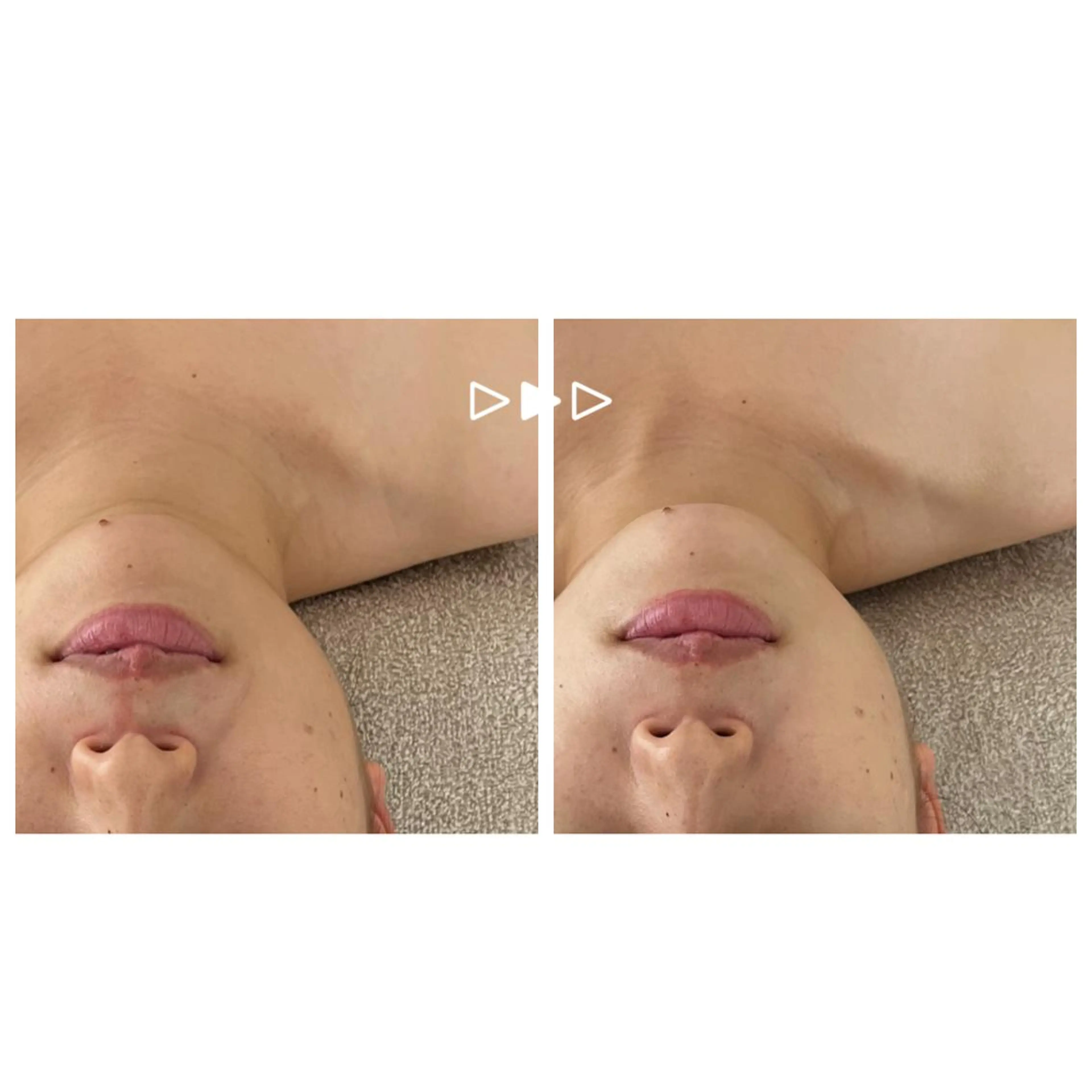 roomRe MAIのエステ・リラクイメージ