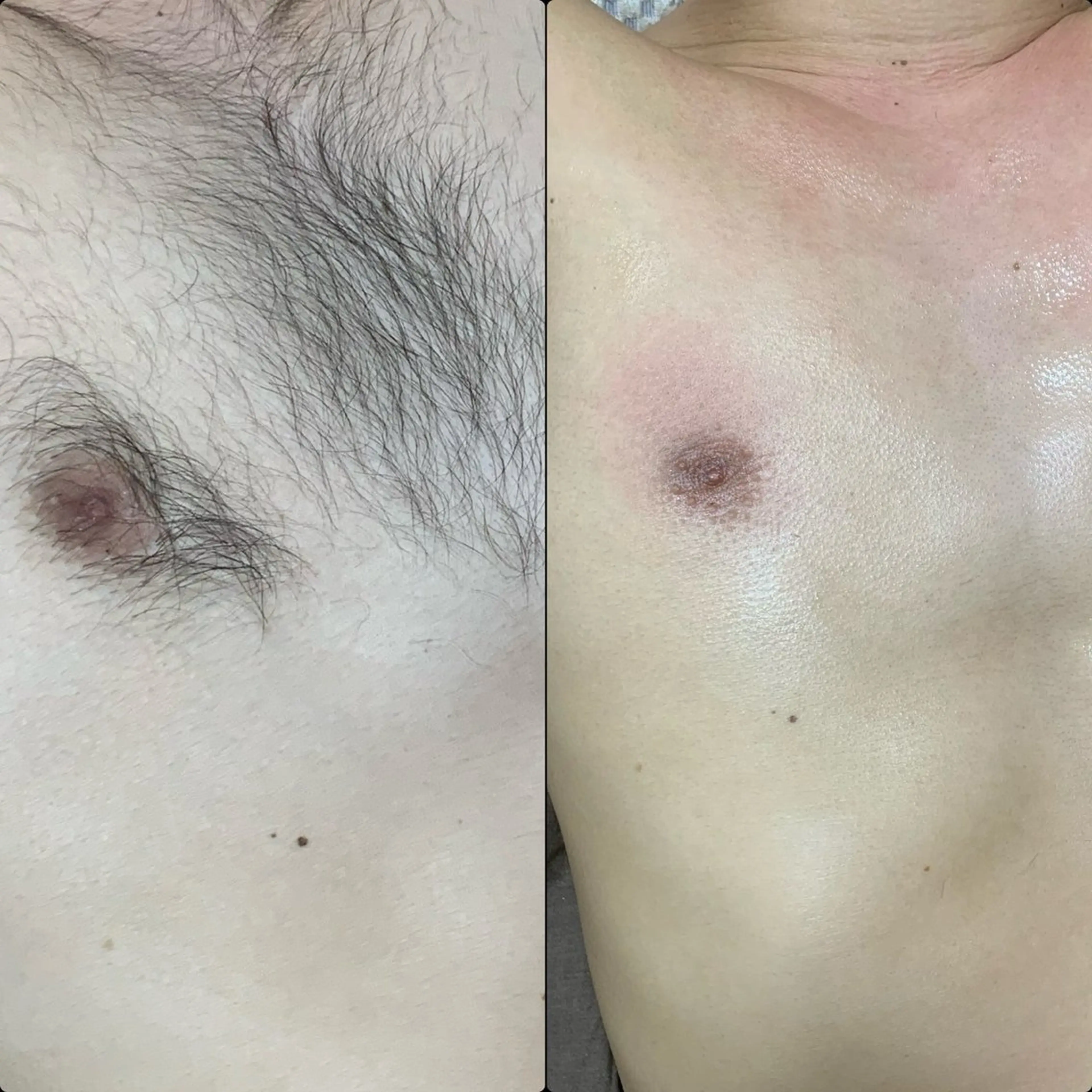 六本木脱毛andS さおりのエステ・リラクイメージ