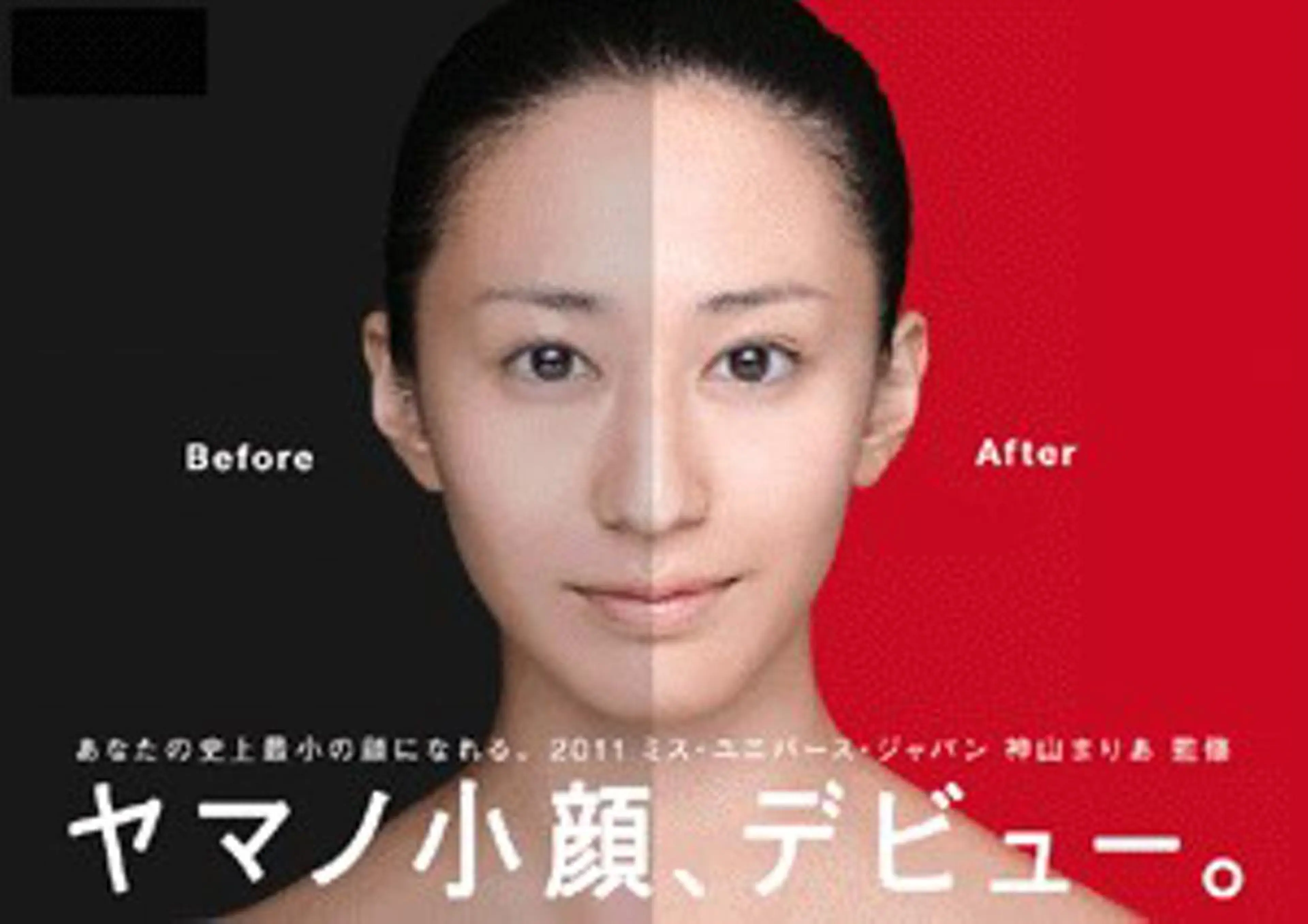 小顔エステの写真