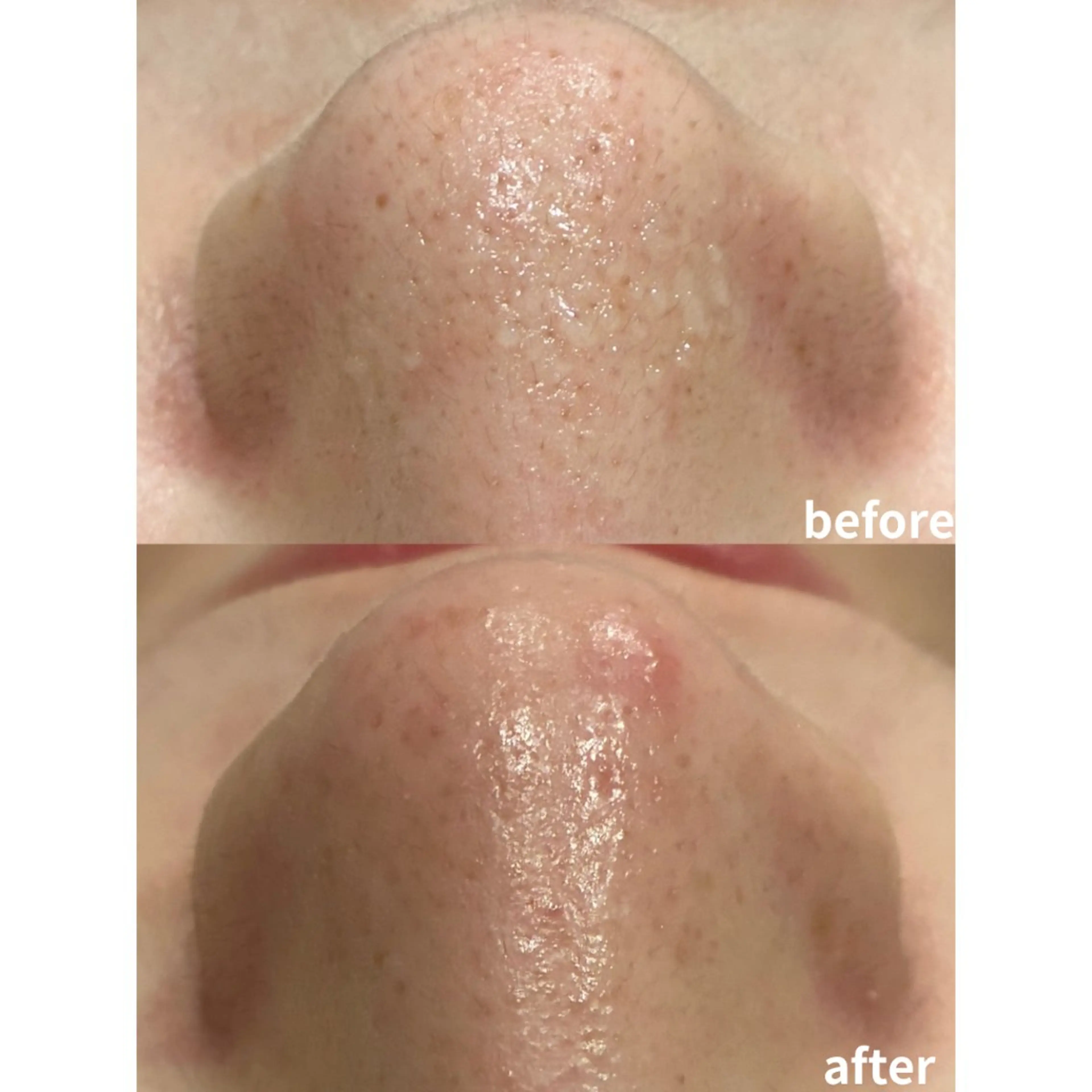 脱毛 DahliaBeauty ダリアビューティー所属・Dahlia痩身脱毛 フェイシャル 中村のエステ・リラクイメージ