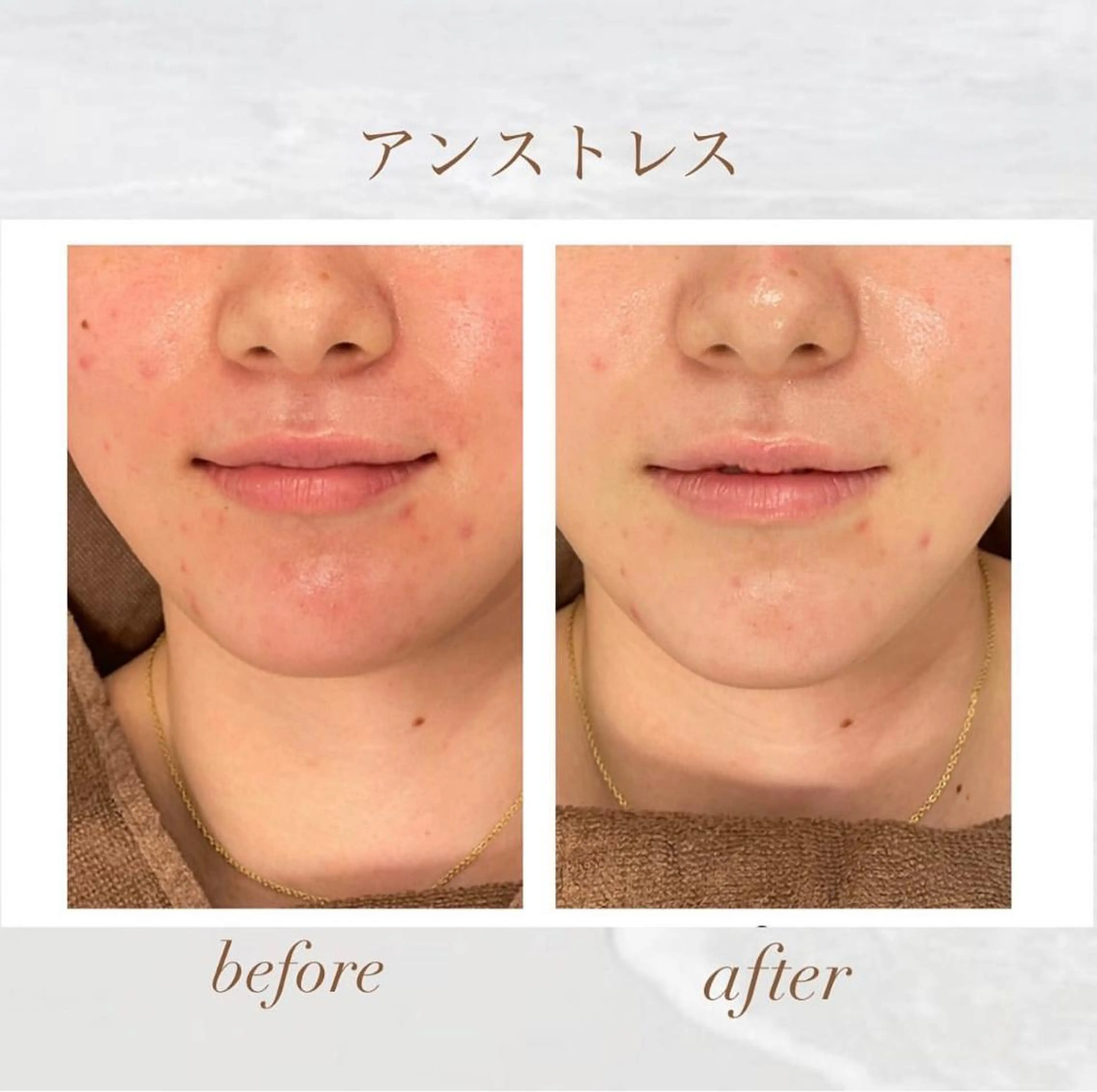 エステ 🦋美肌サロン. maho🦋のエステ・リラクイメージ