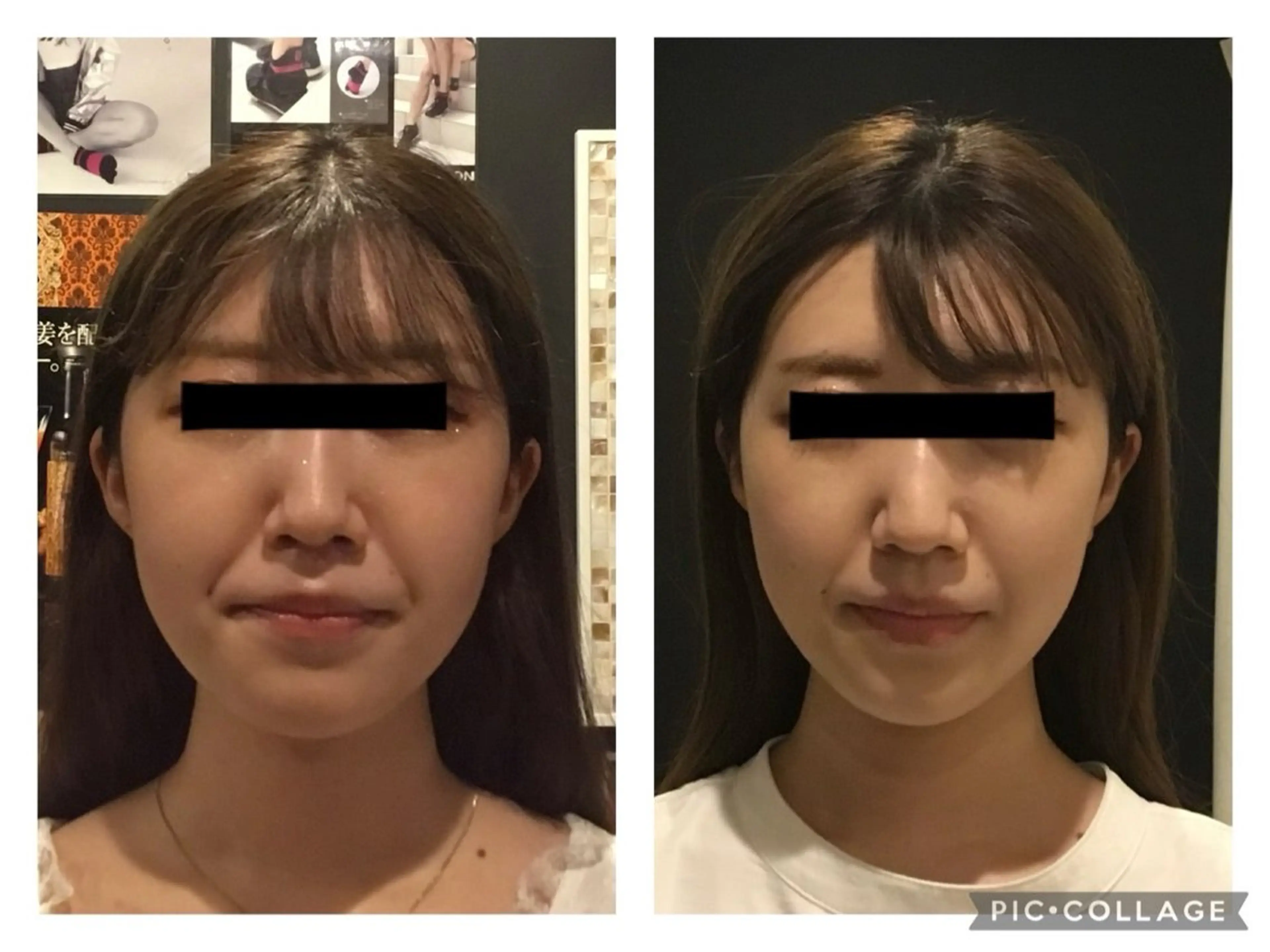 【オーダーメイドコース】頭から脚まで全て施術し、その人の綺麗を引き出します💡の写真