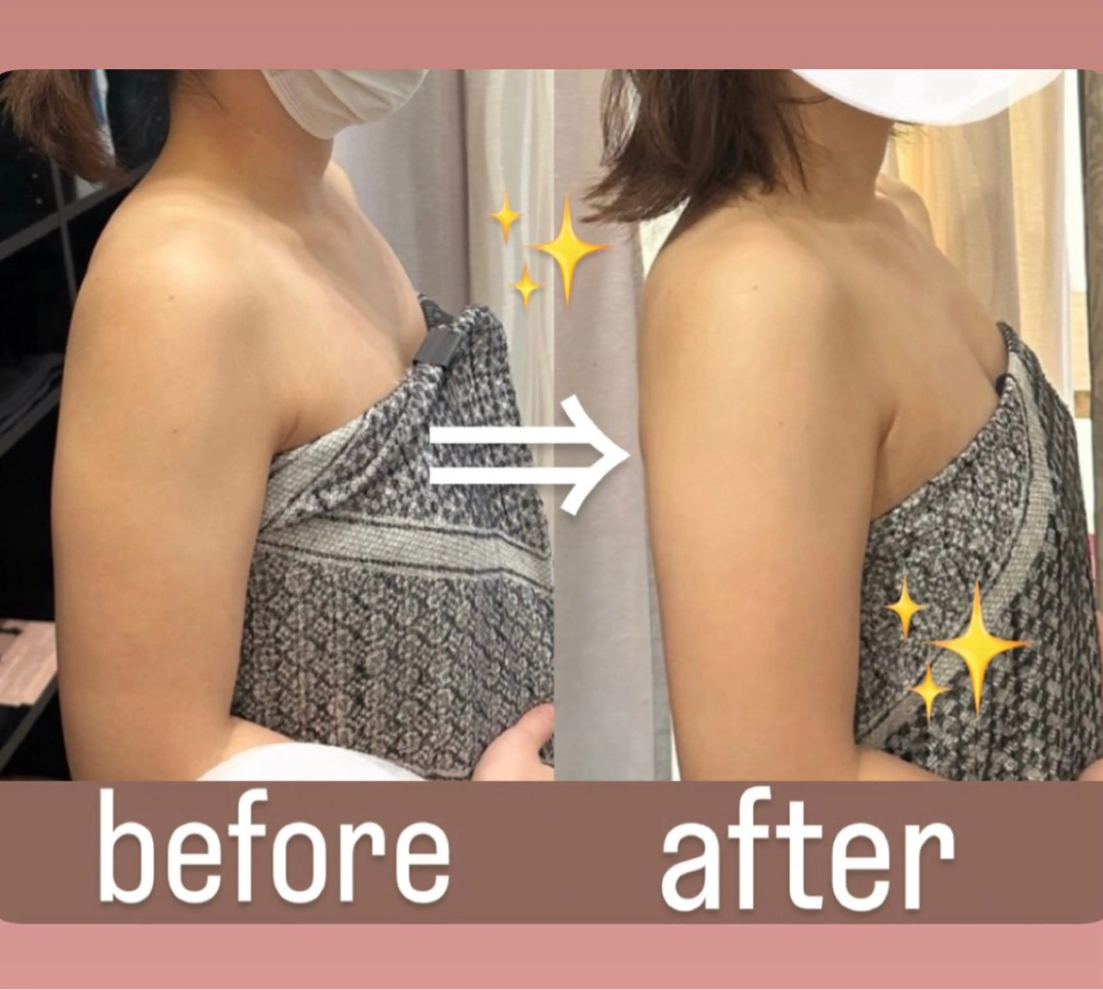 リラク 浮腫|肩こり|張り 日々の疲れを解消⭐️のエステ・リラクイメージ