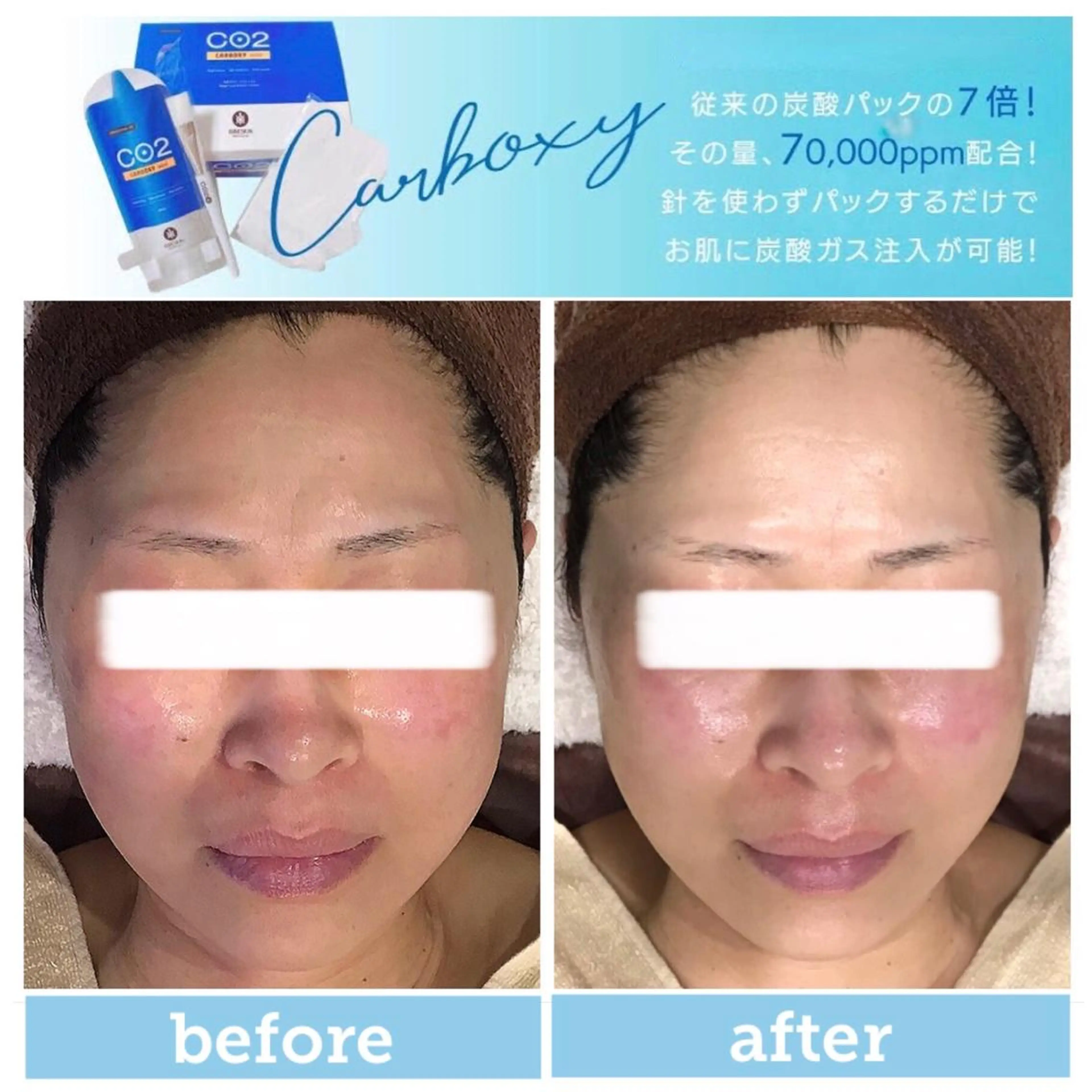 エステ エステサロン JURISのエステ・リラクイメージ