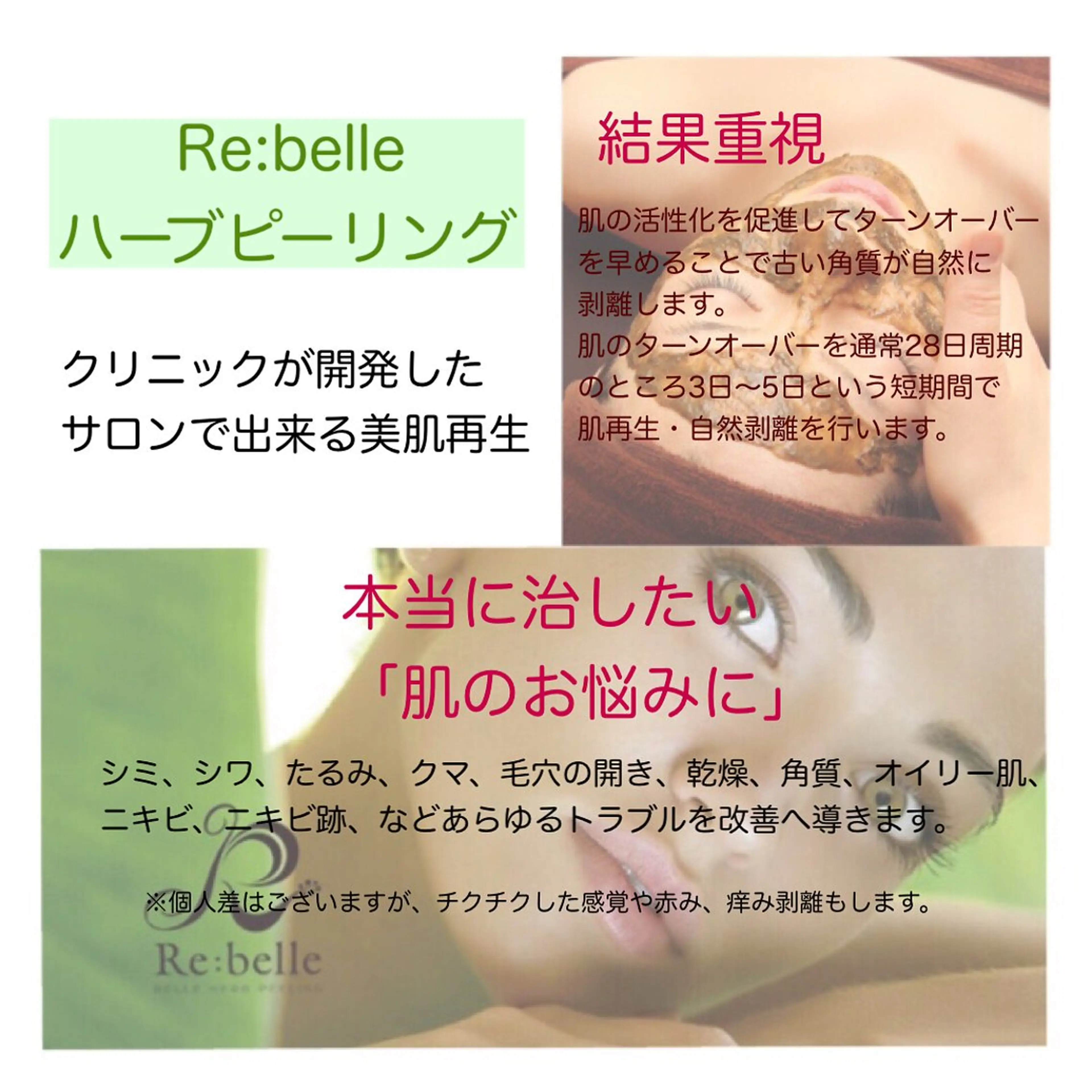 エステ 【リベルハーブピーリング認定店】敏感肌・美白脱毛専門店Dione立川店所属・Dione 立川店のエステ・リラクイメージ