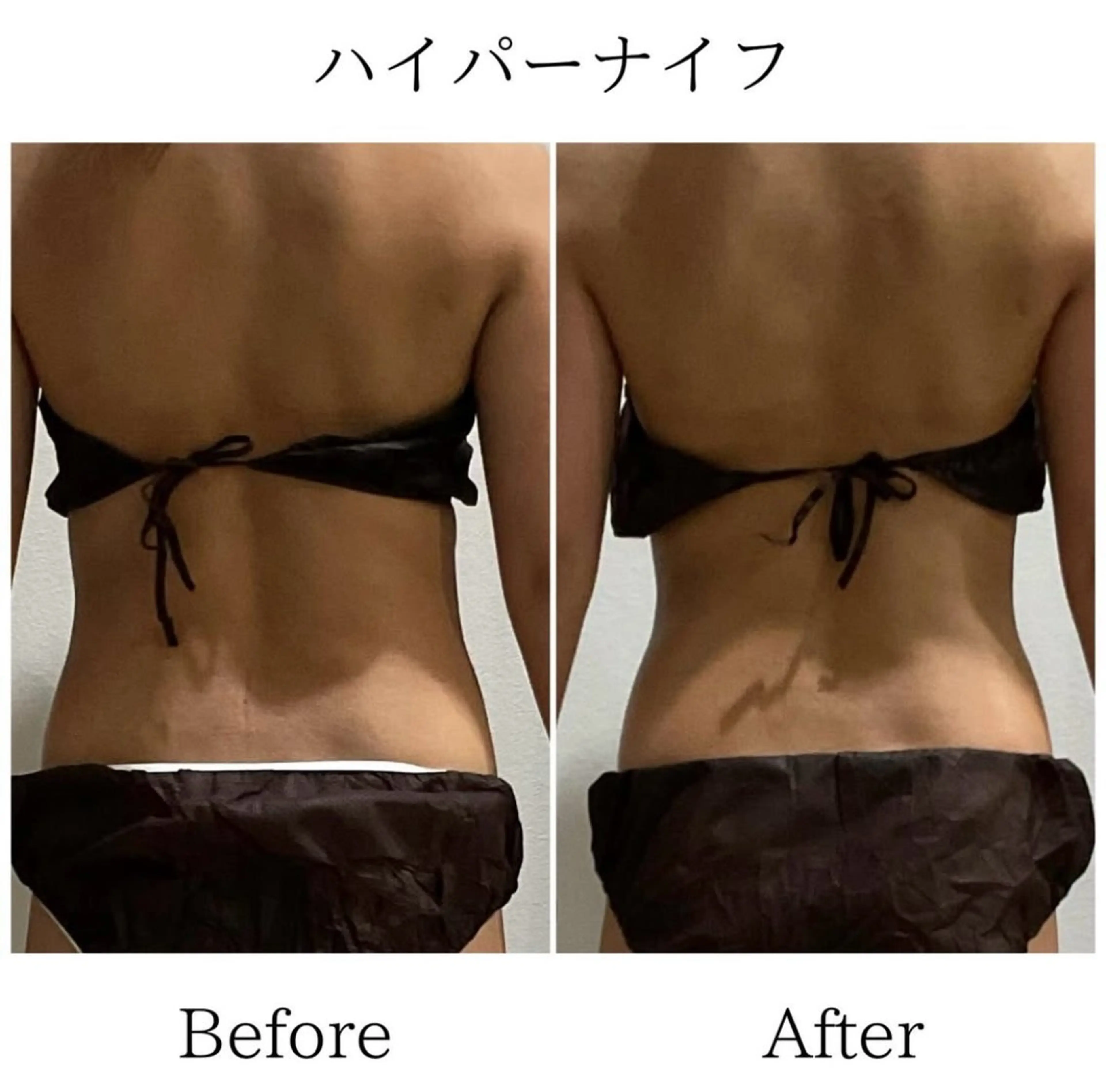 エステ LiLL by Andre beauty所属・LiLL 熊本のその他イメージ