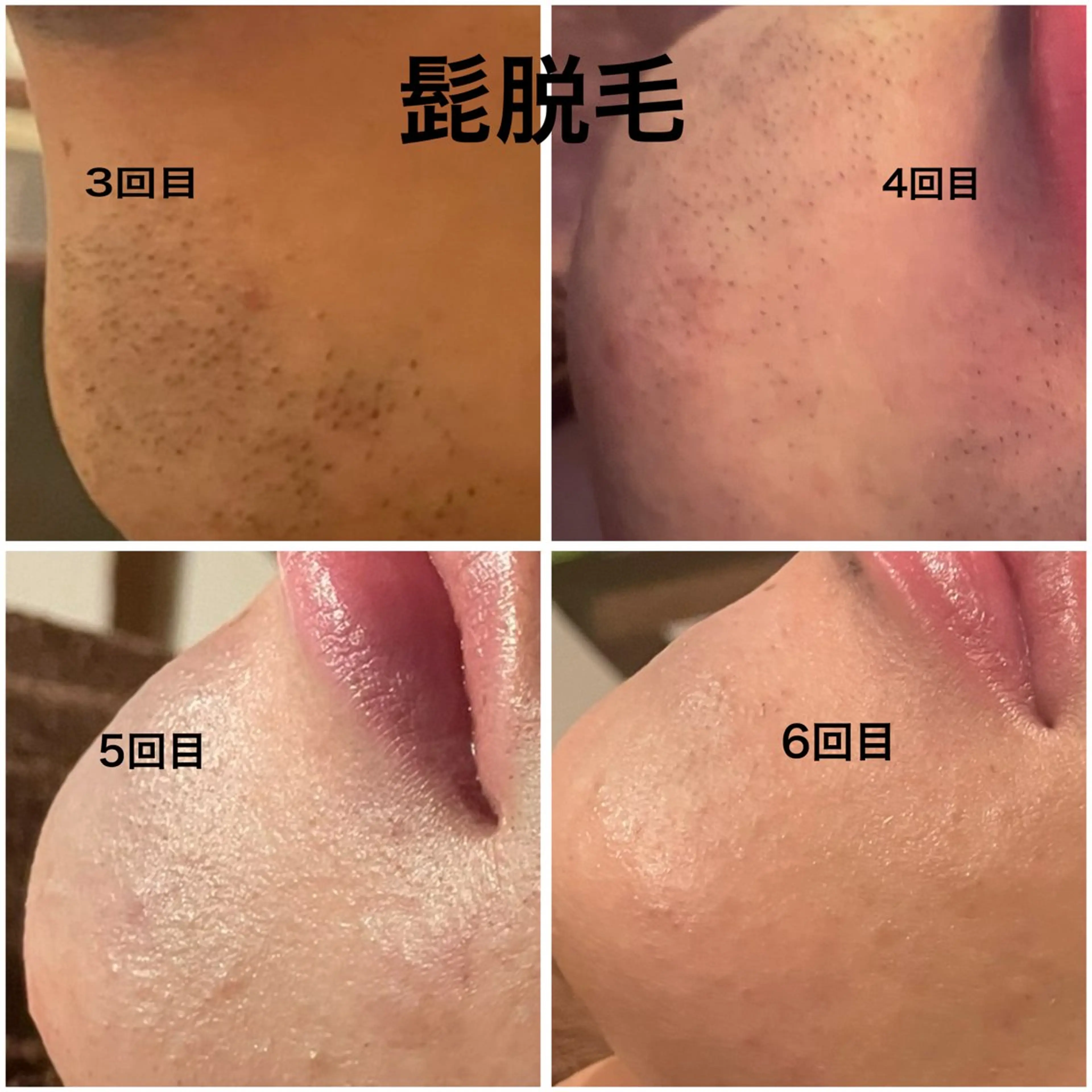 メンズ espoir-K 横浜のエステ・リラクイメージ