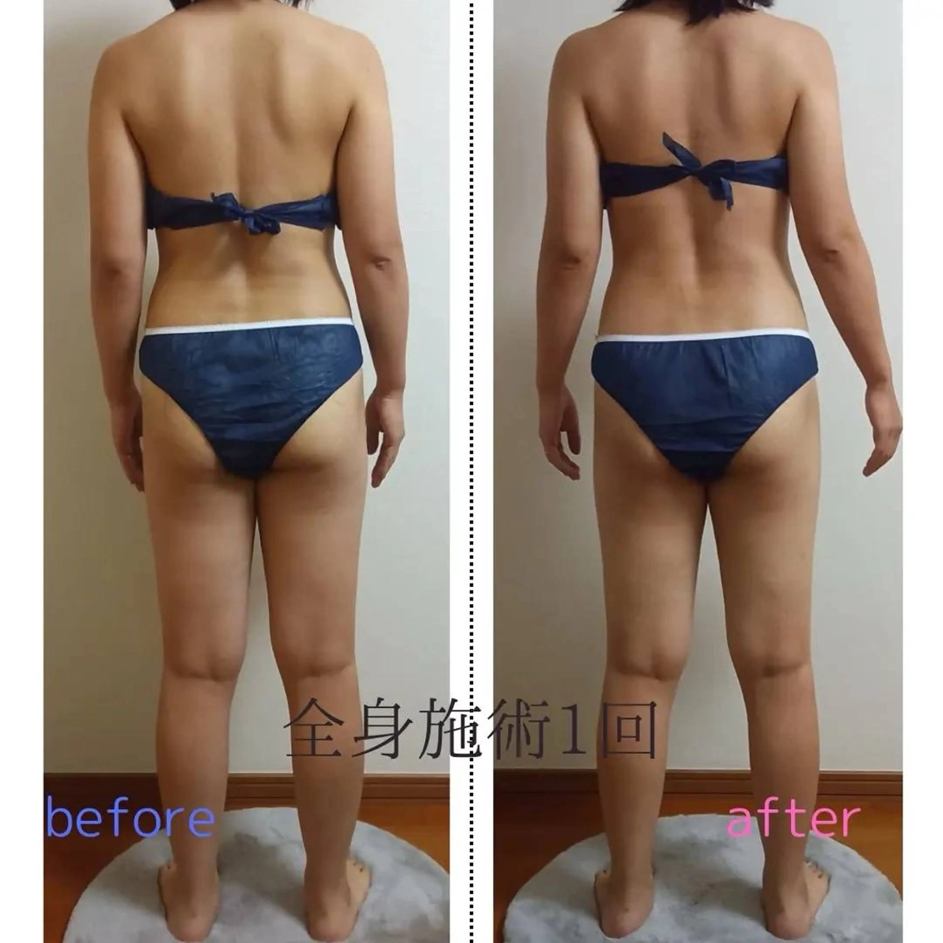 ACORAL痩身 NAZUKIのエステ・リラクイメージ