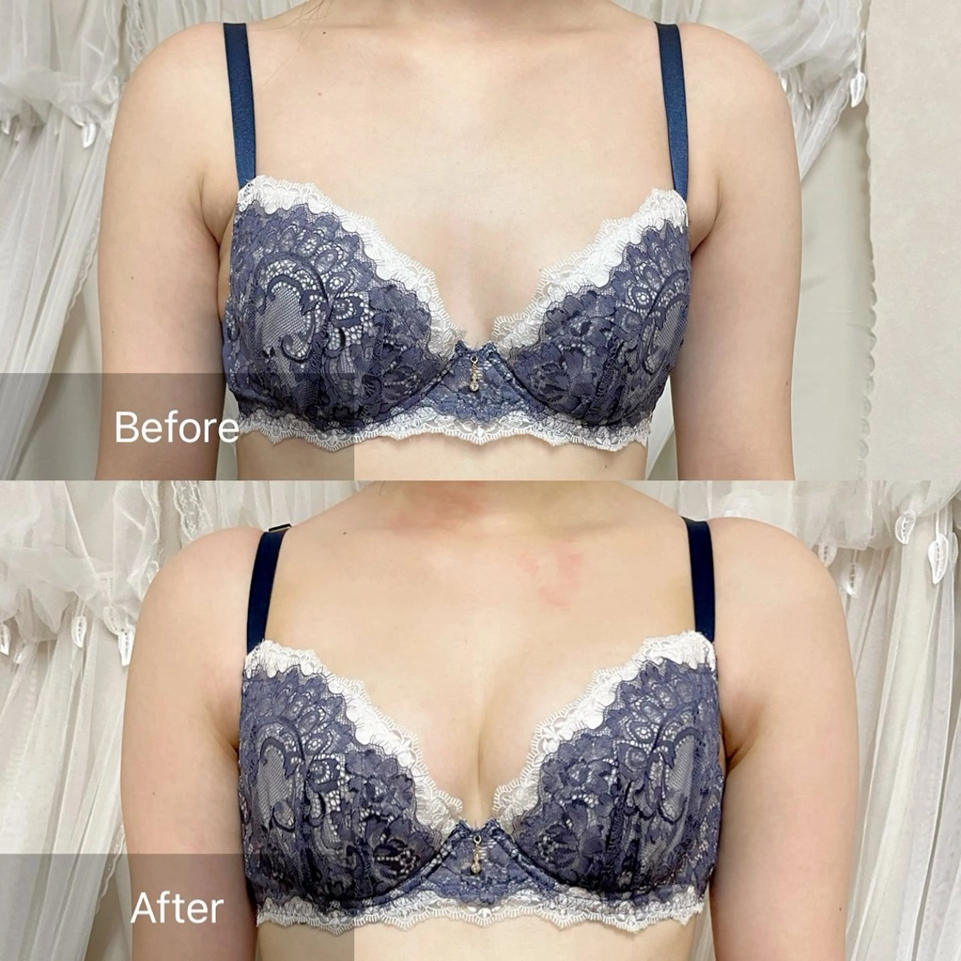 エステ バフトアップ/ハーブ Nornのエステ・リラクイメージ