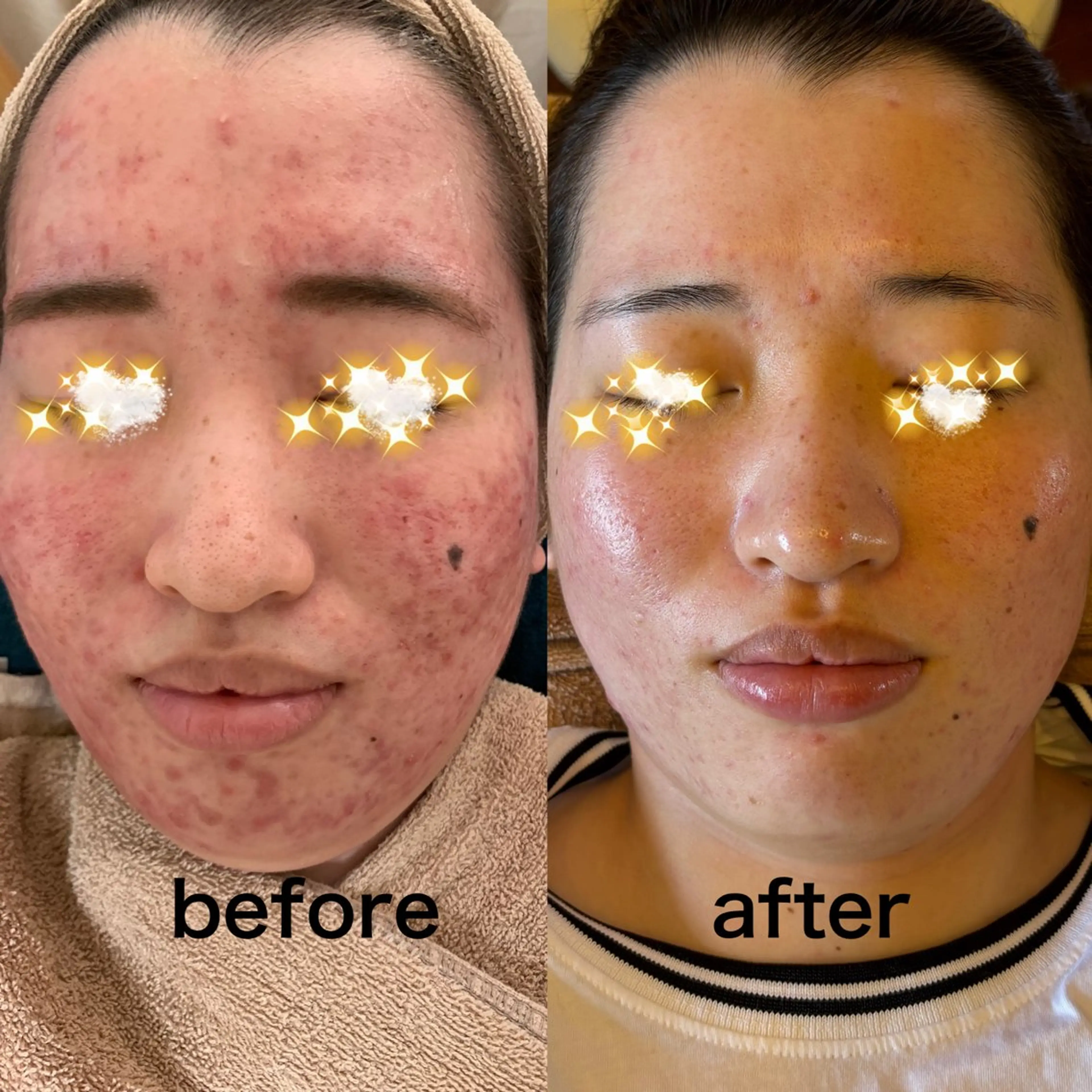 エステ エステサロン グラマラスのエステ・リラクイメージ