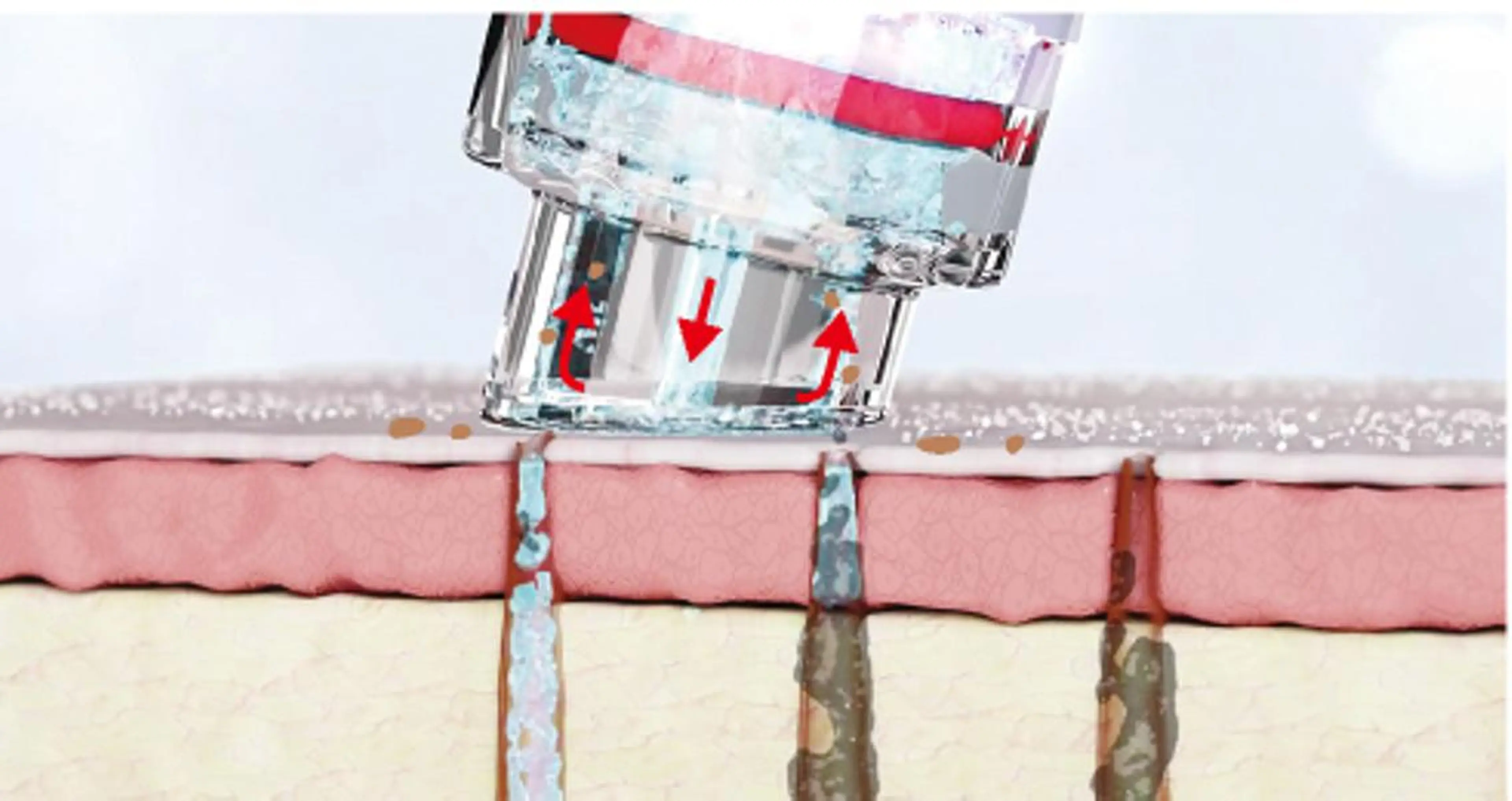 ニキビ/敏感肌/乾燥 Lilyauraのエステ・リラクイメージ