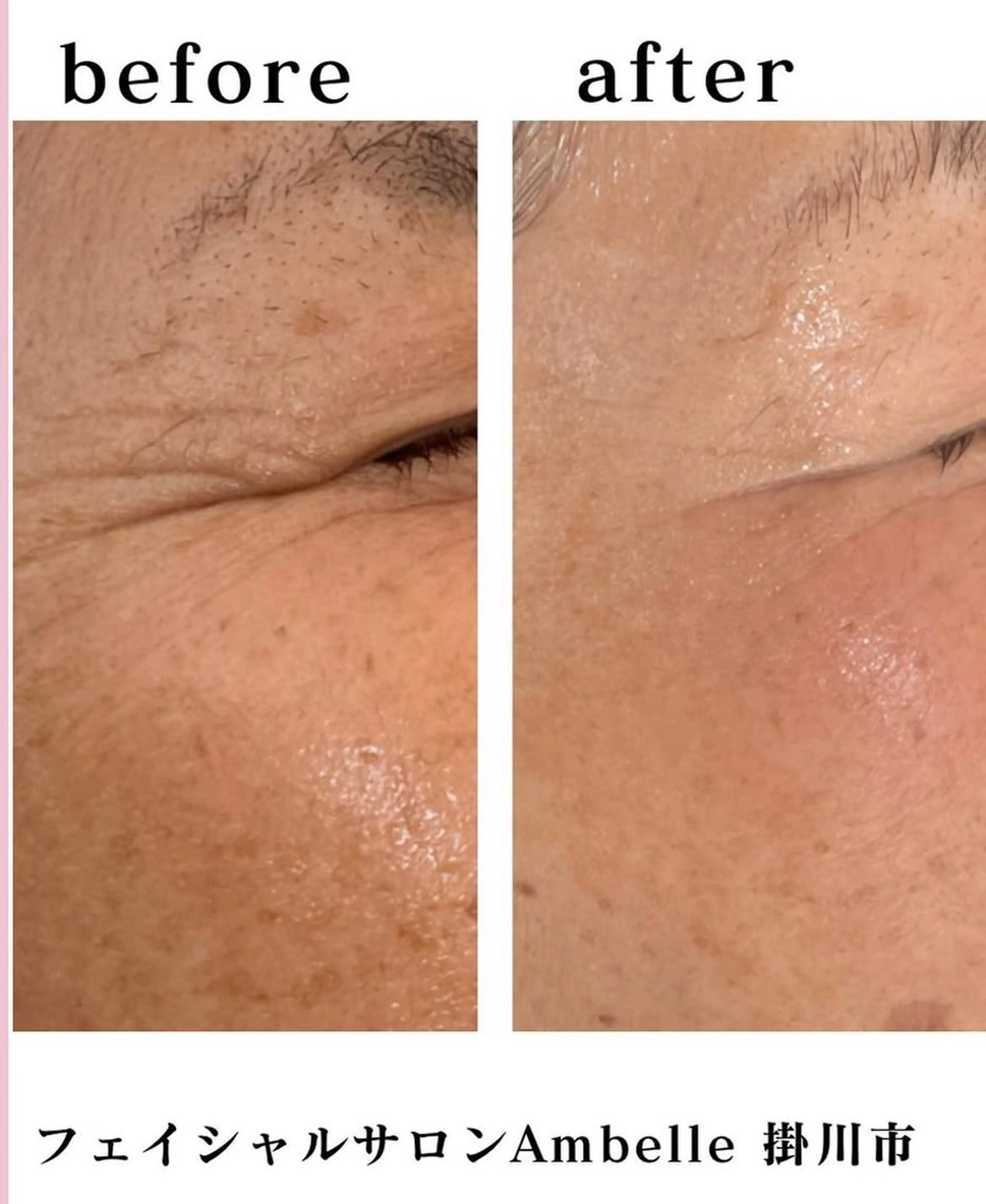 サロン　Ambelle所属・北川 亜友美のエステ・リラクイメージ