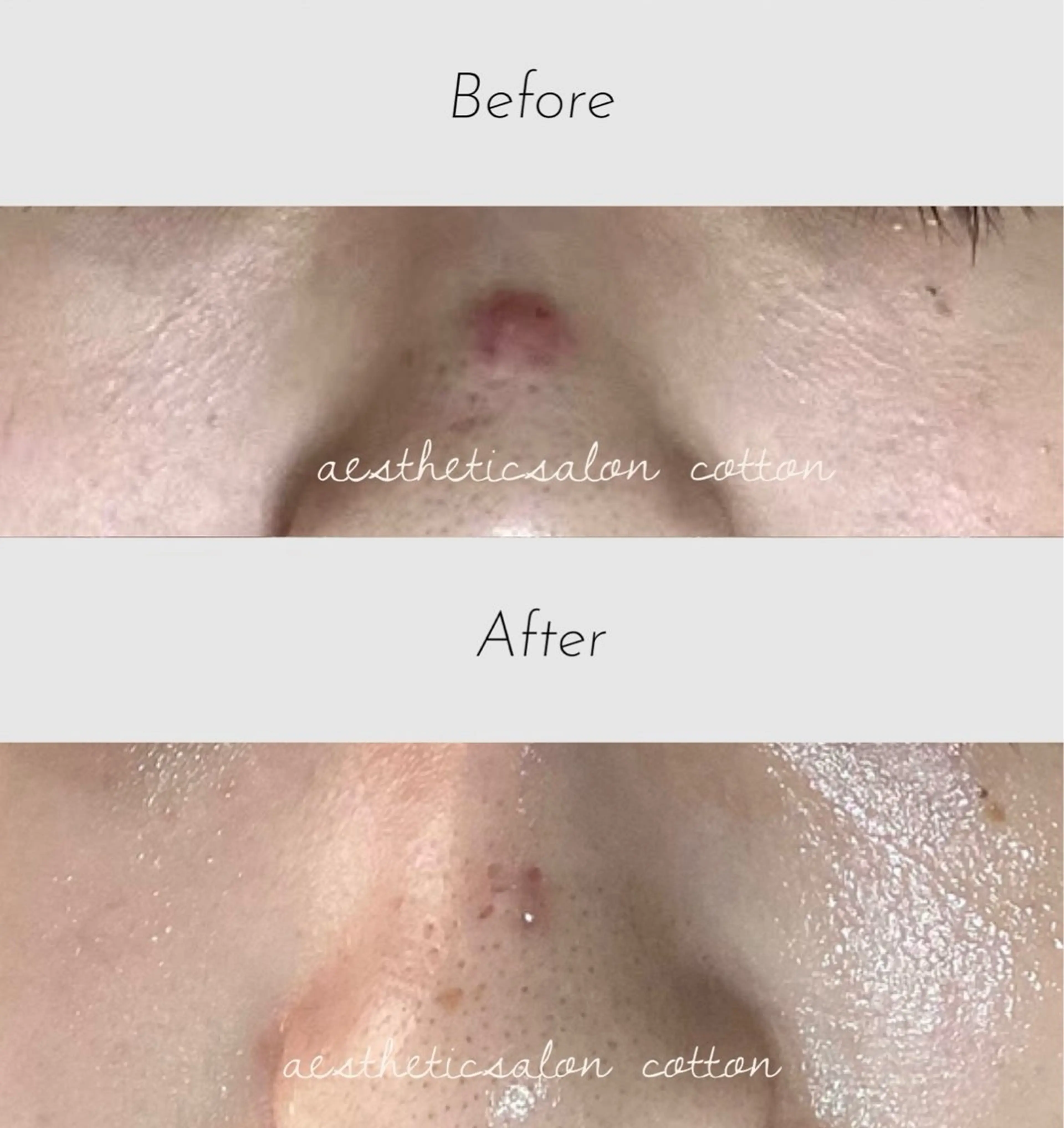 エステ 都度払い 肌質改善専門サロンのエステ・リラクイメージ