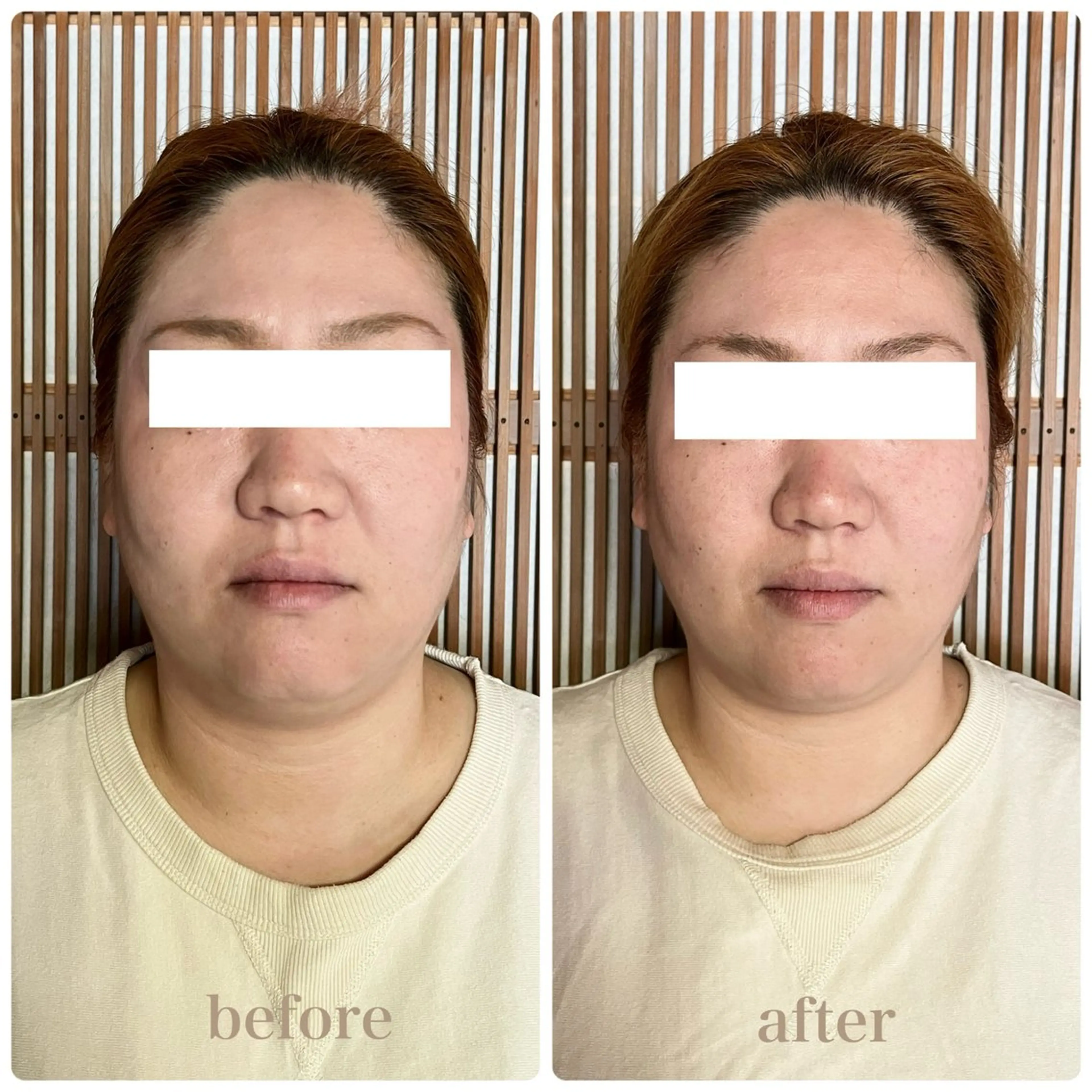 ルコナビューティ所属・小顔・歪み専門　井元 朋子のエステ・リラクイメージ