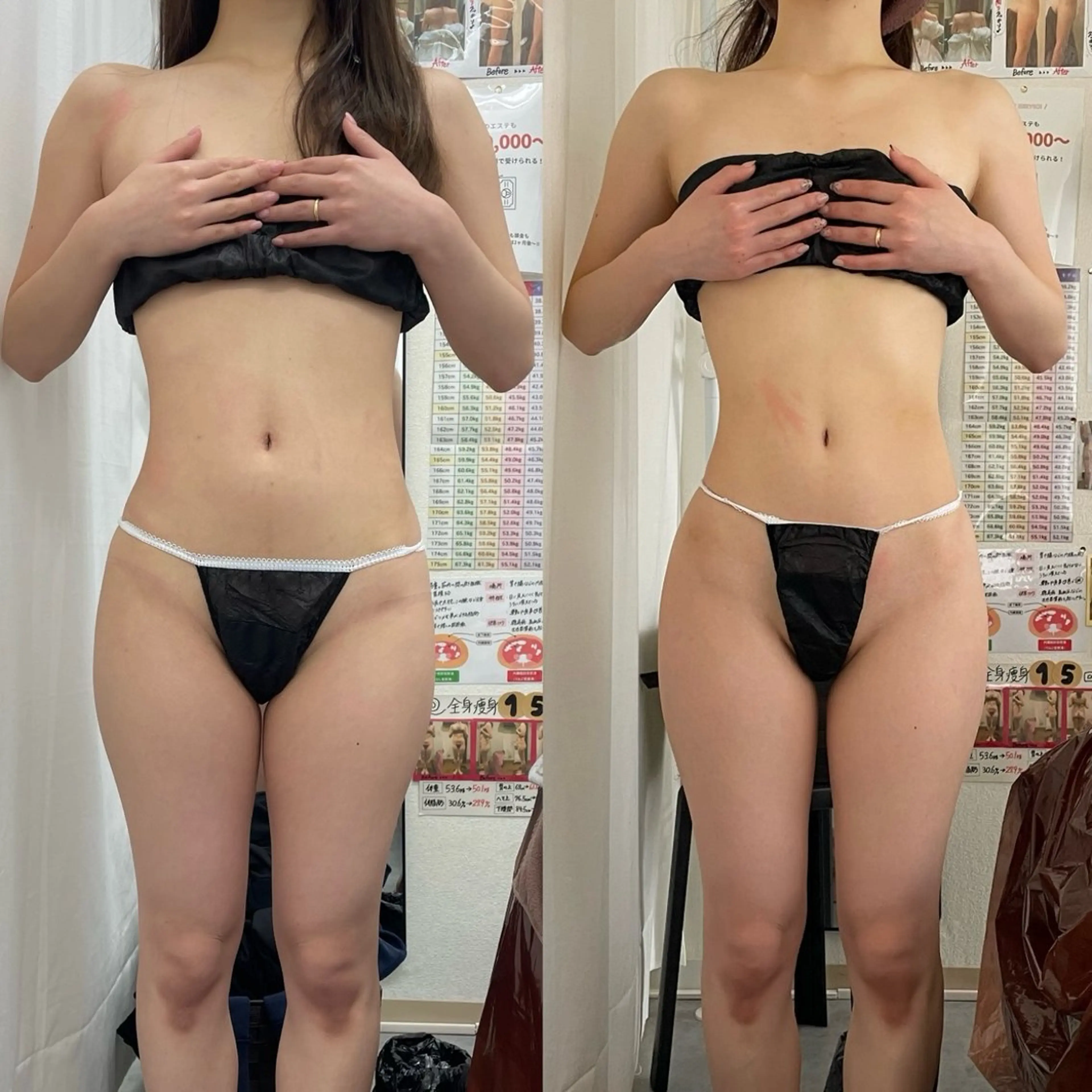 エステ リラク espresso,所属・《痩身、小顔専門店》 エスプレッソのエステ・リラクイメージ