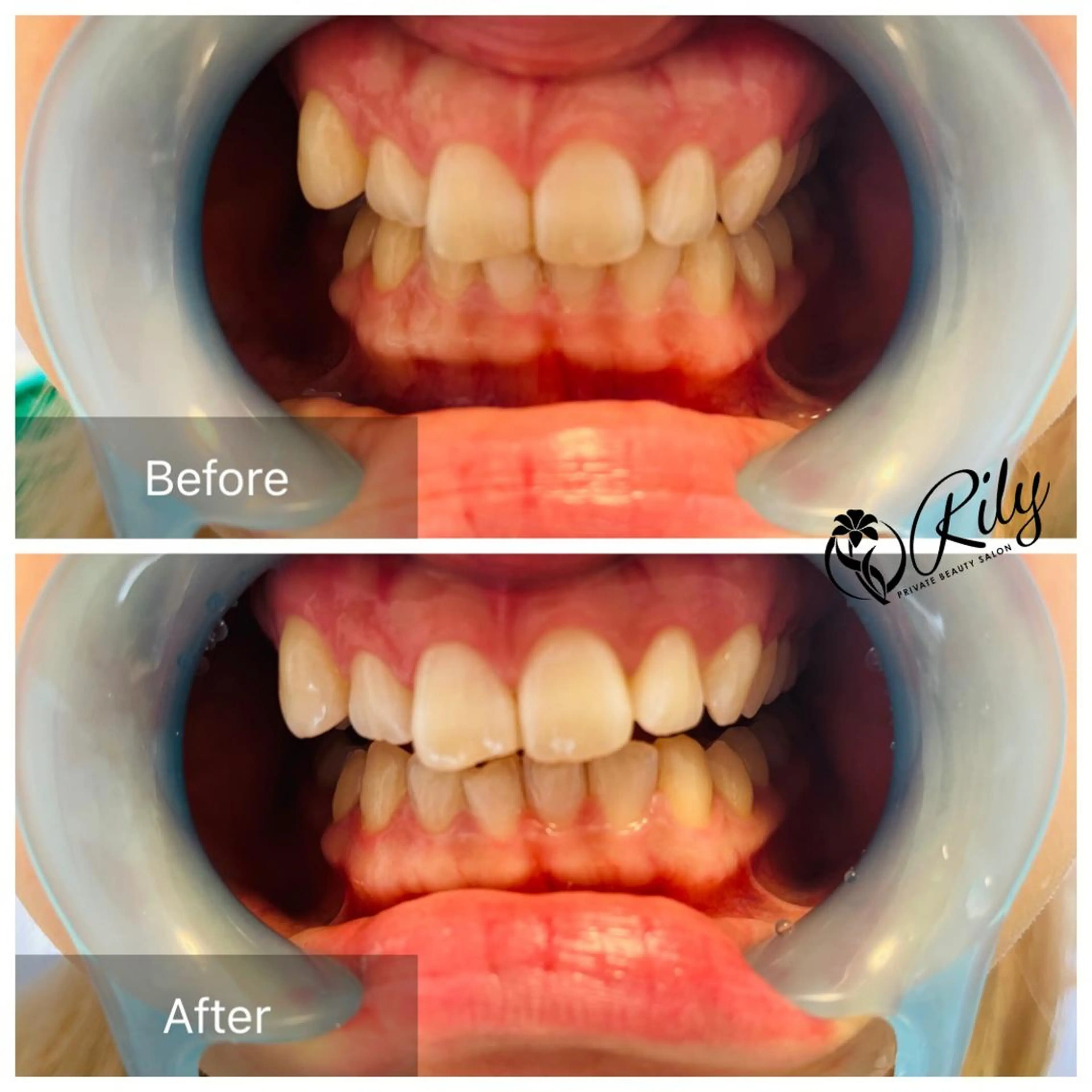 その他 プライベートサロン RILYのエステ・リラクイメージ
