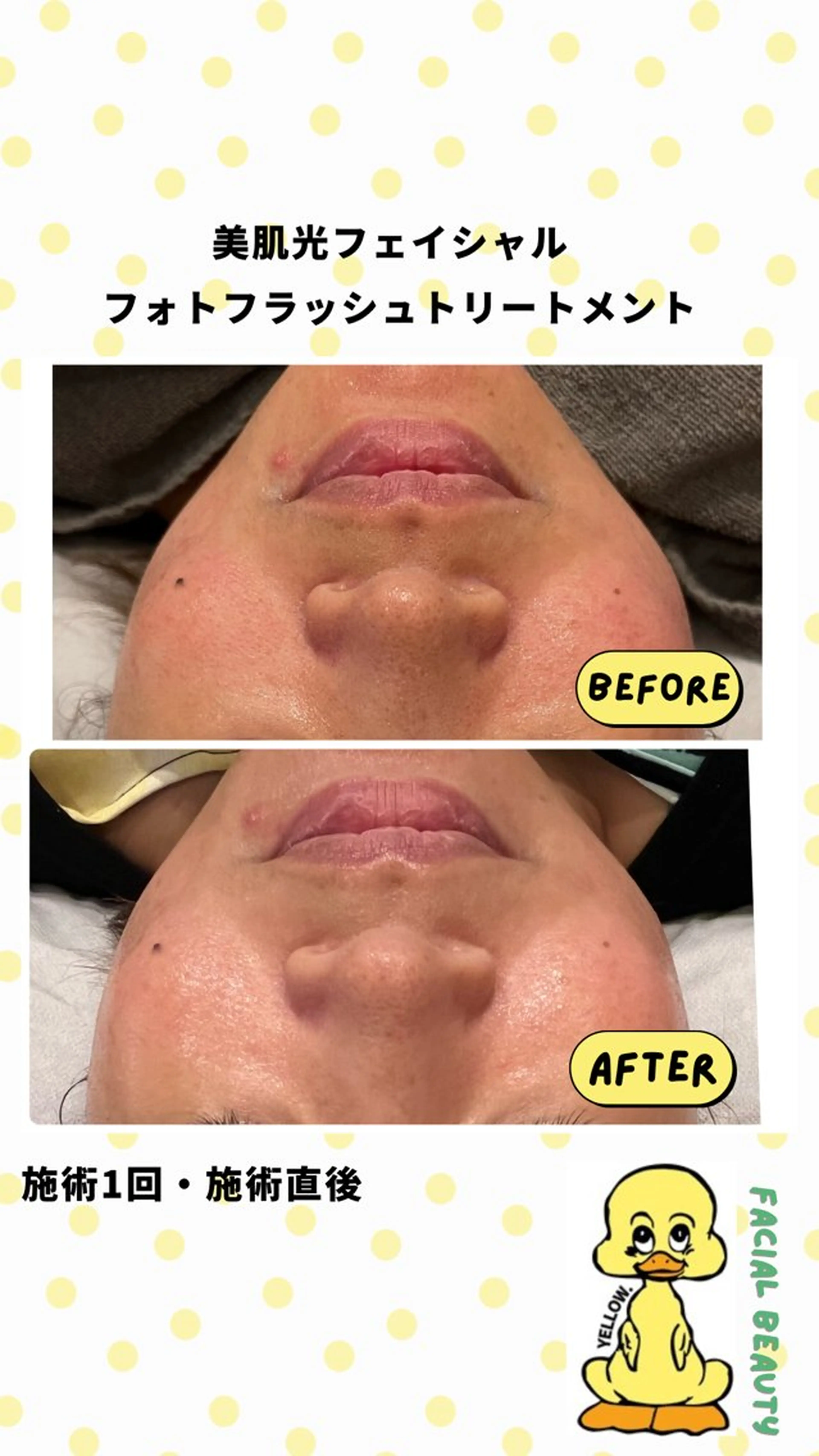yellow.所属・yellow💛【 脱毛&フェイシャル】のエステ・リラクイメージ