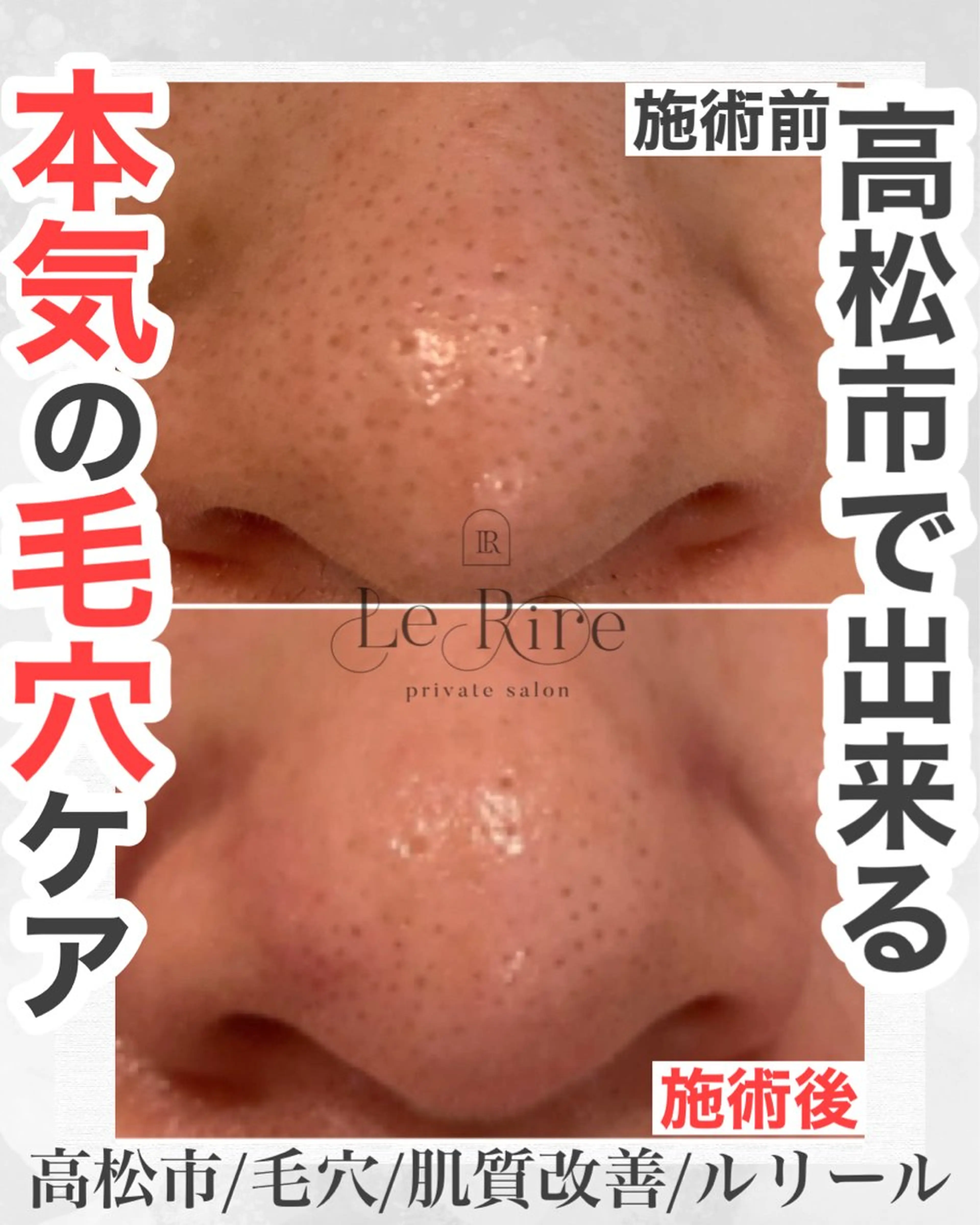 エステ プライベートサロンLe Rire【ルリール】所属・美肌•小顔サロン ルリールのエステ・リラクイメージ