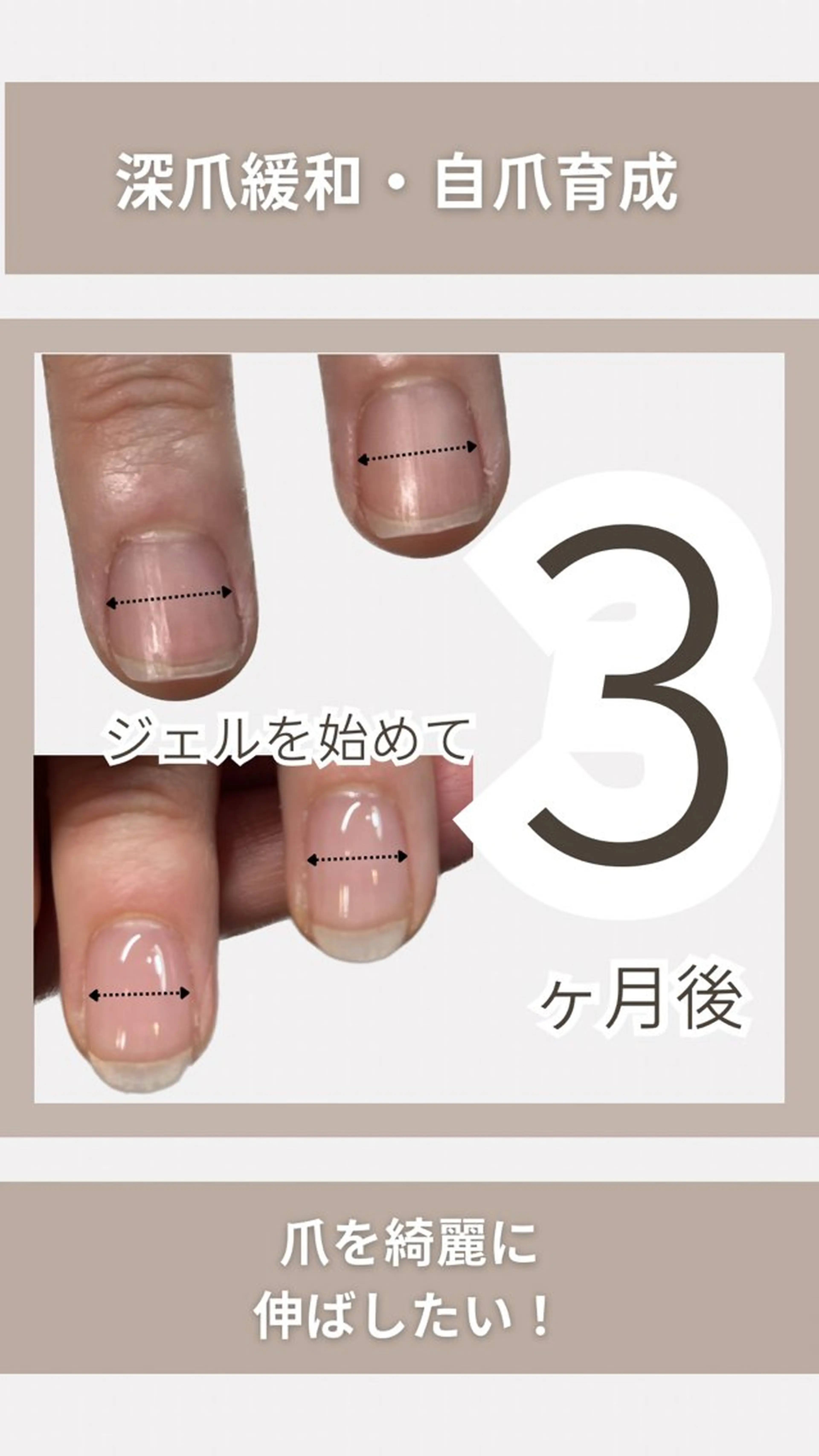 ネイル KIKOA NAIL キコアネイルのネイルデザイン