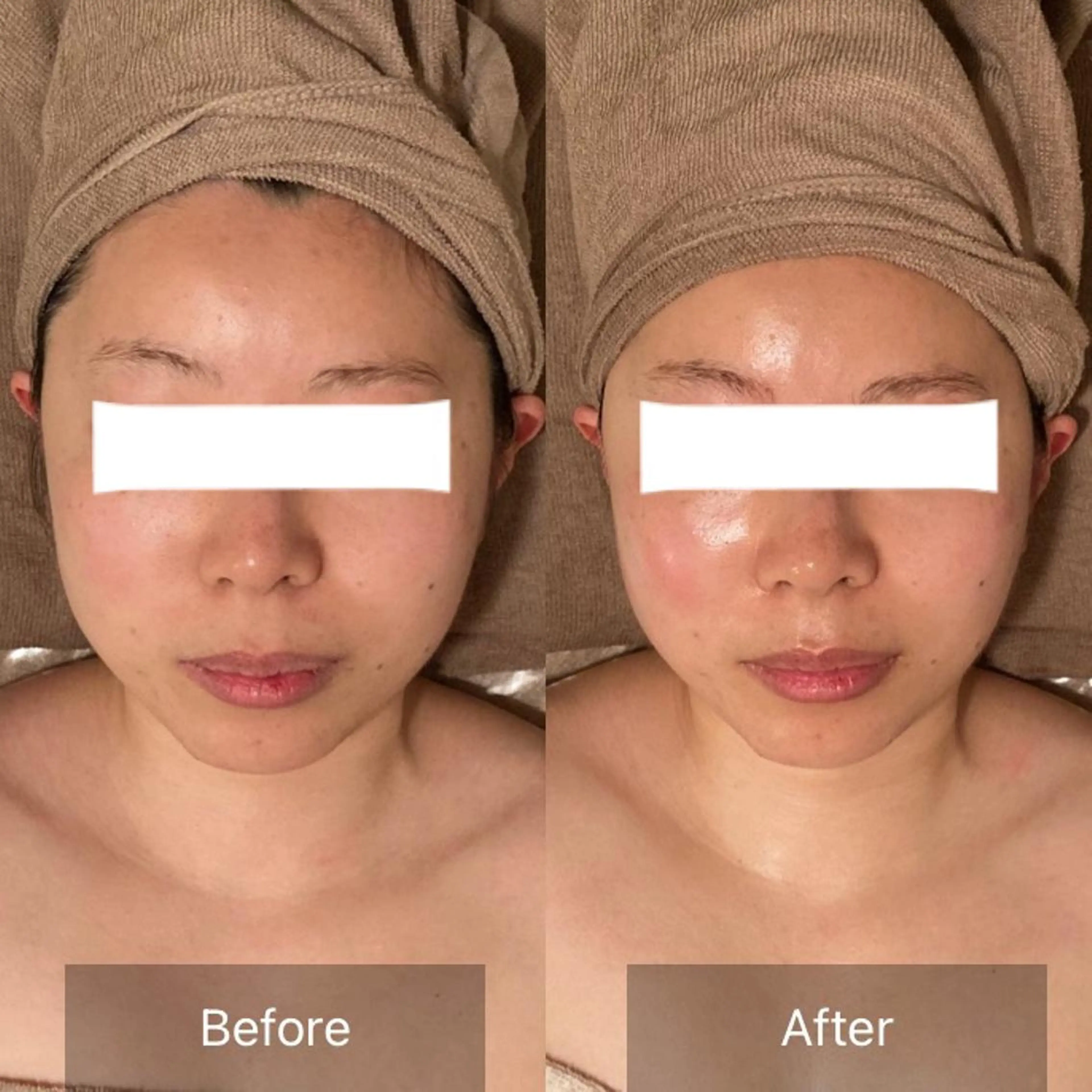 Ｂ&H所属・頭痛•肩こり専門/ 眉サロンB&H心斎橋のエステ・リラクイメージ