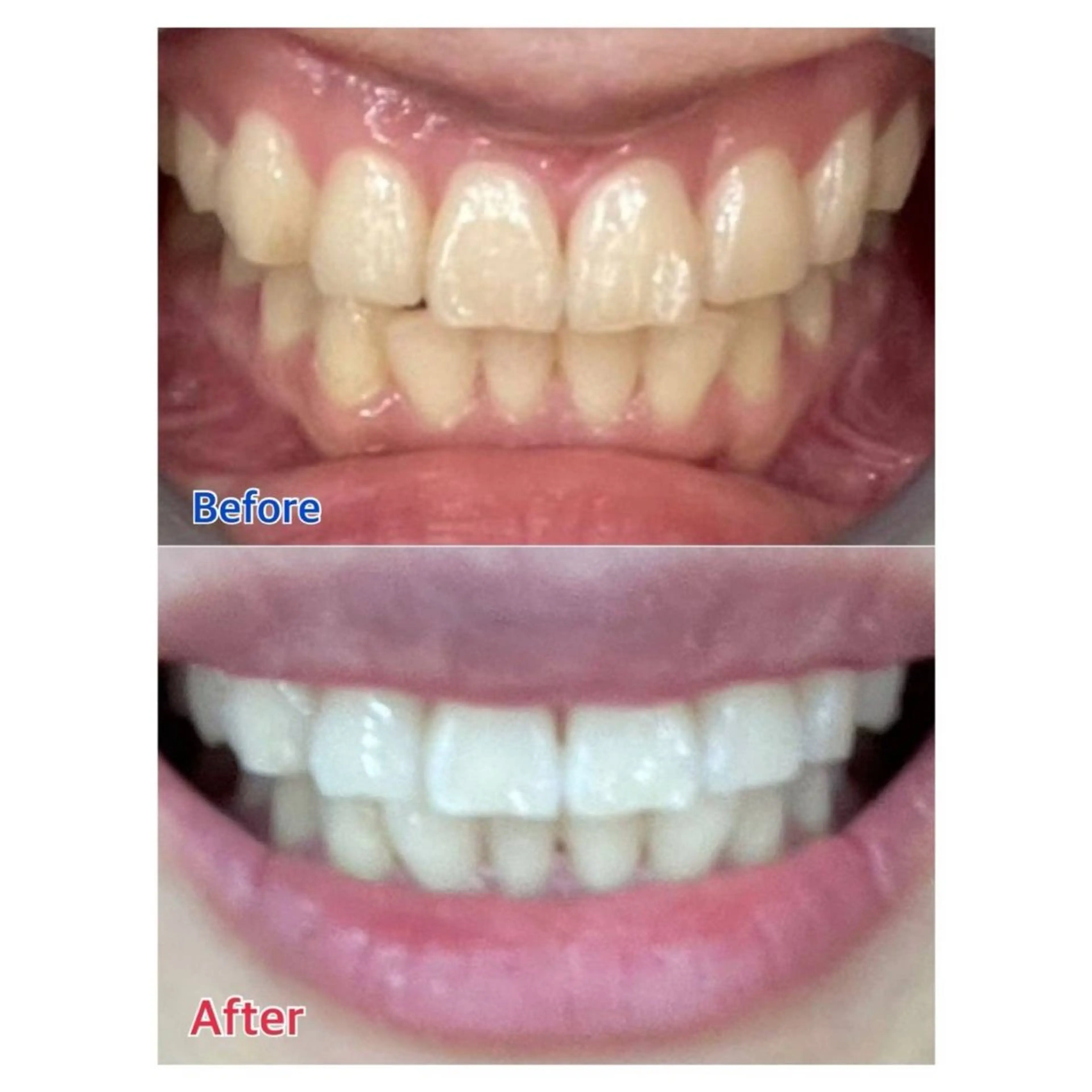 MBEAUTYSALON 千葉店・京成大久保所属・Melty 輝のその他イメージ