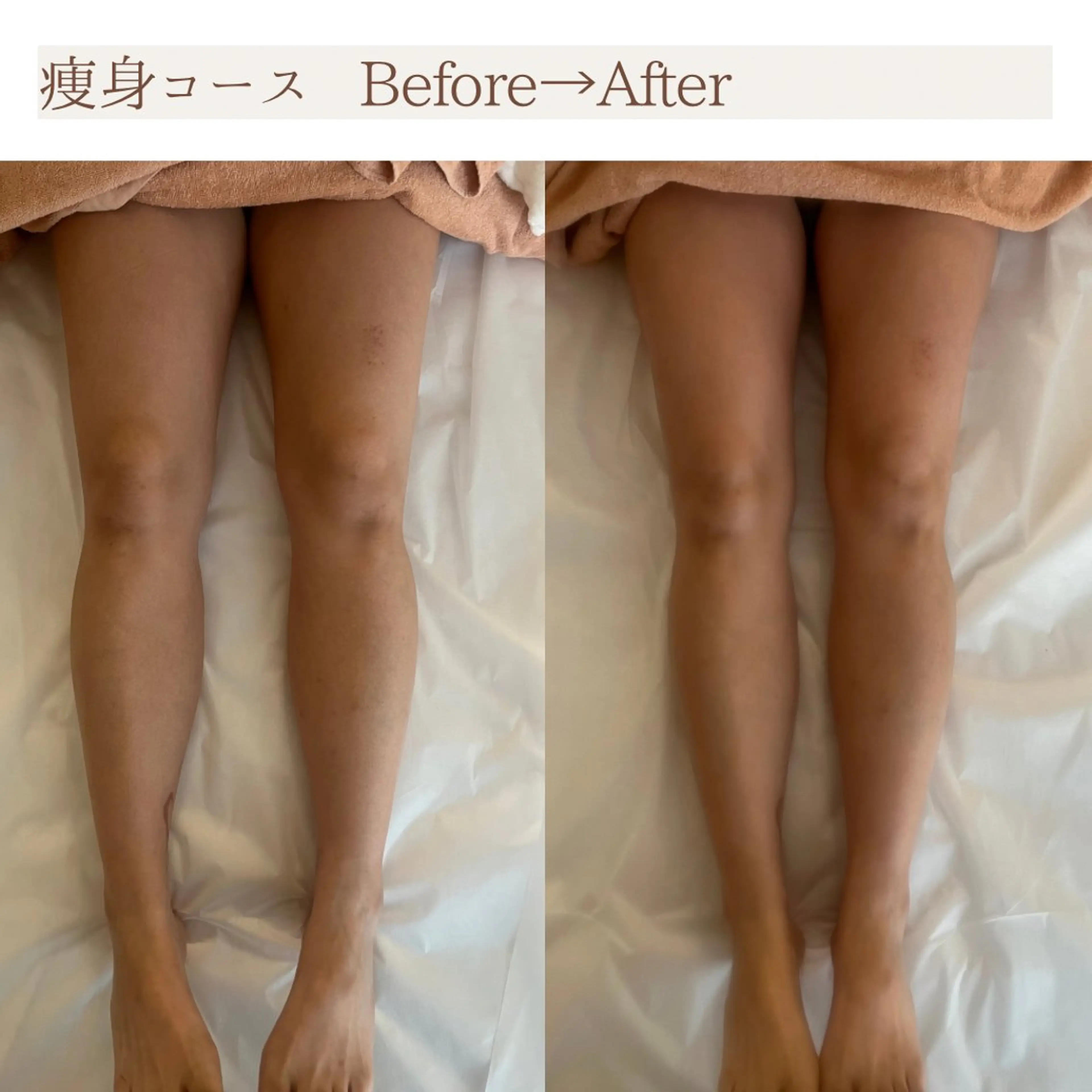 Total Beauty salon Bloom所属・肌育WISHpro 専門サロンBloomのエステ・リラクイメージ