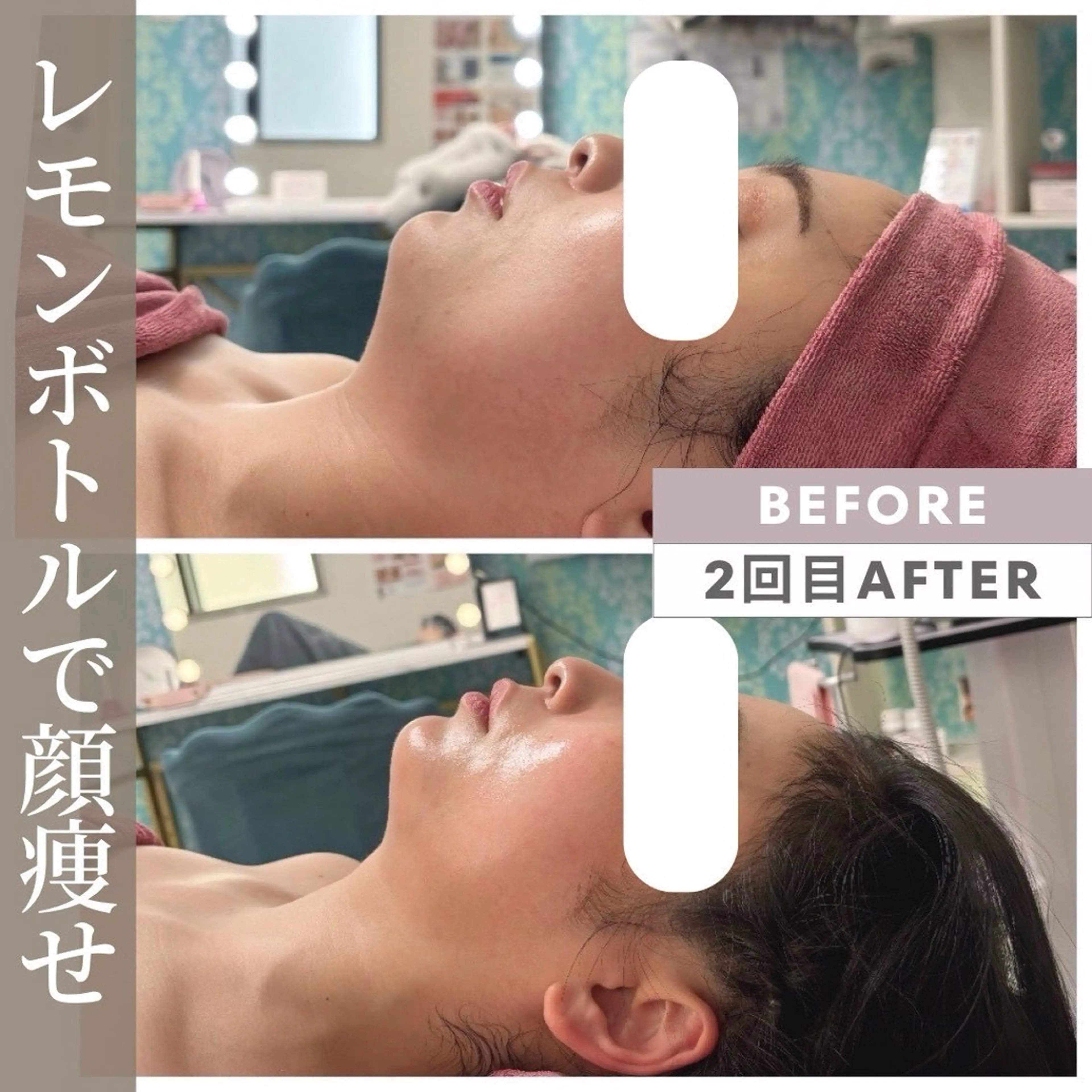 【小顔リフト×小顔矯正専門店】RED所属・猿渡 ひかるのエステ・リラクイメージ