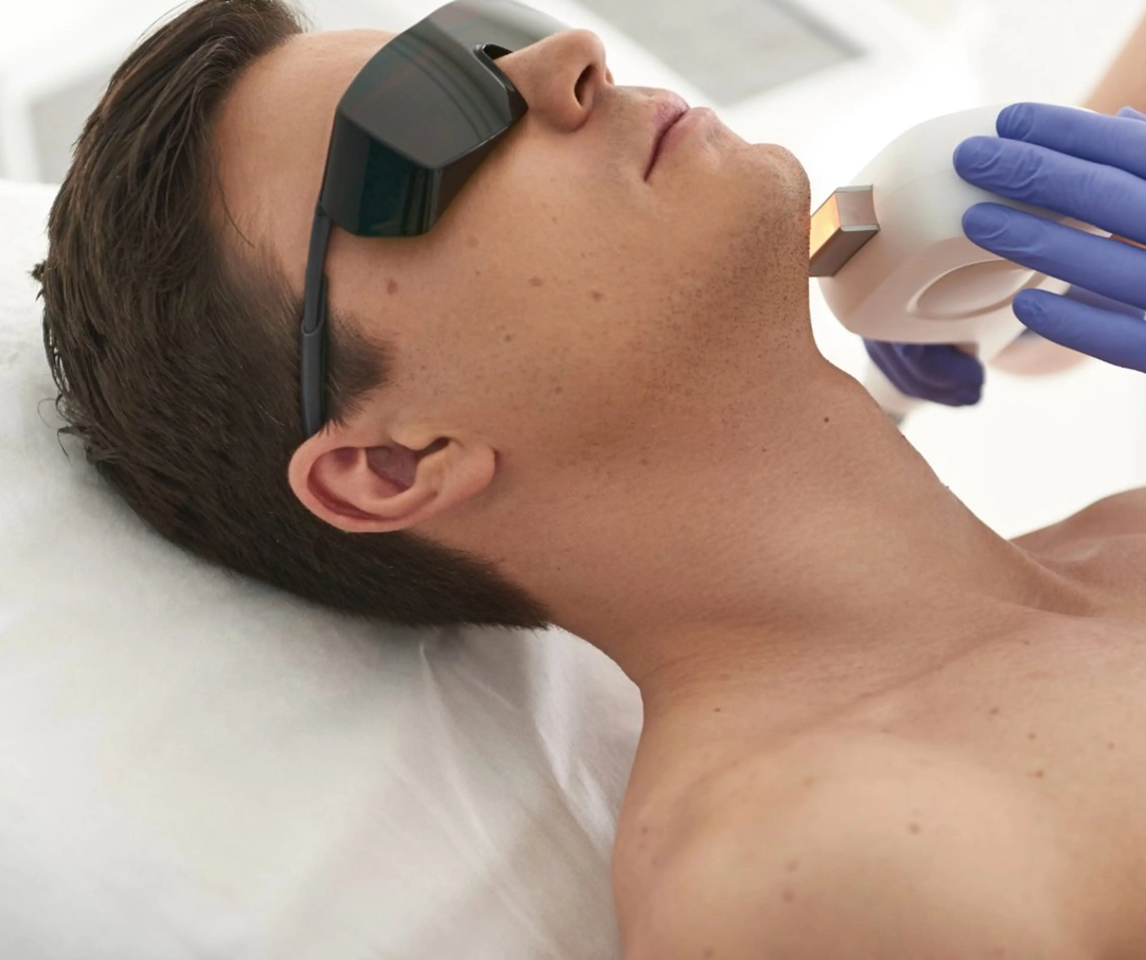 メンズ| 全顔脱毛の写真