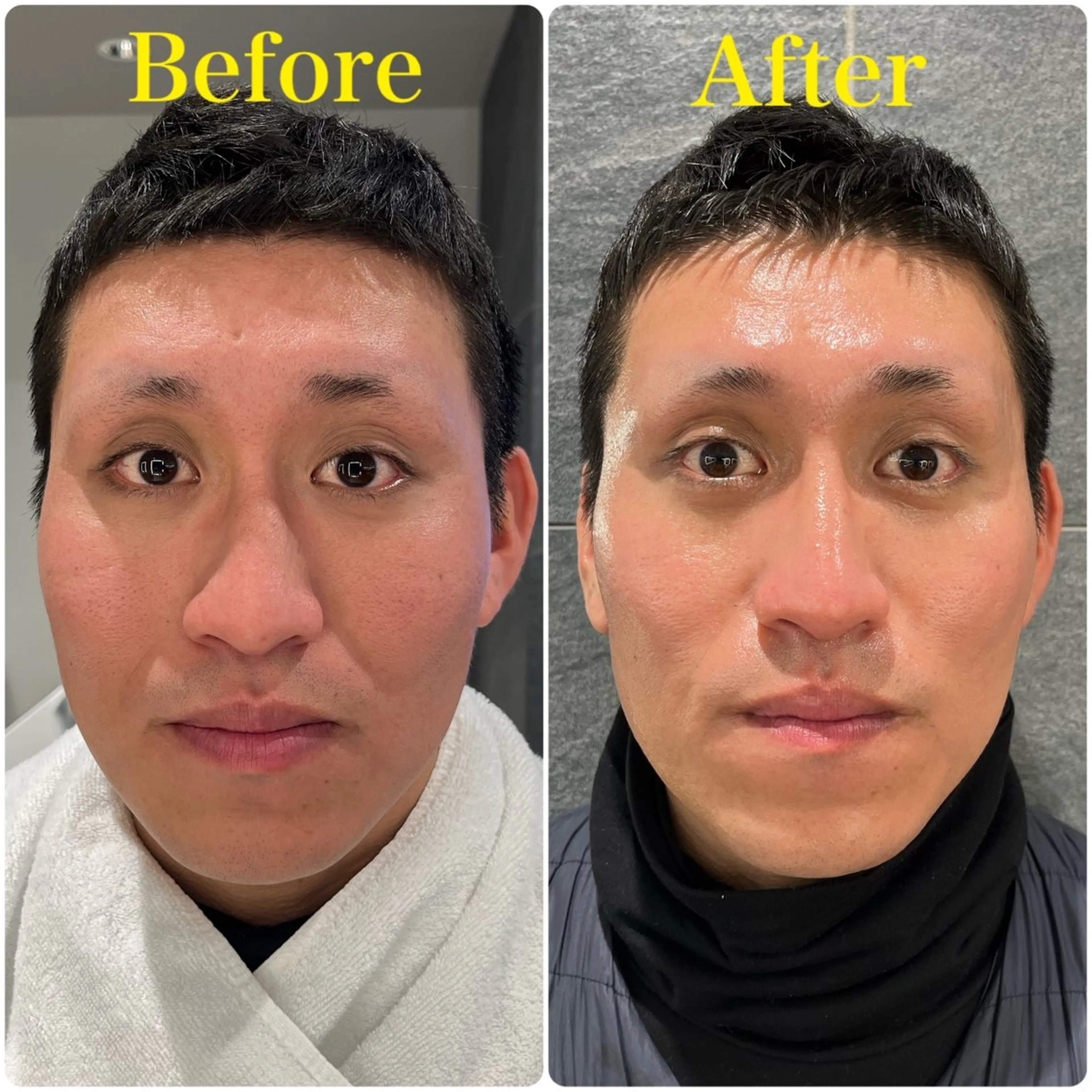 エステ DeCoLé Beauty所属・艶肌/敏感肌/若さ/ ボディ痩身🌿のエステ・リラクイメージ