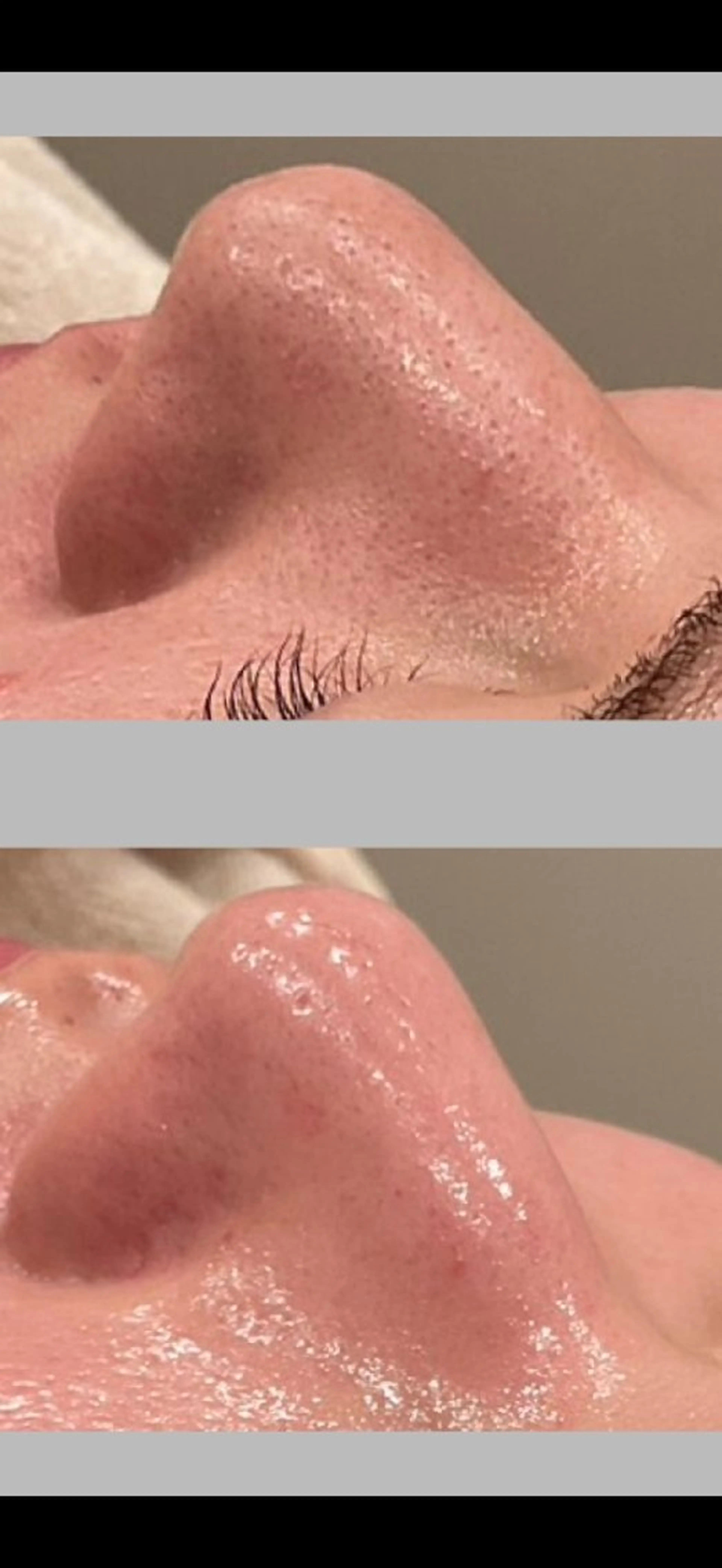 エステ ベル チェリカ 三城のエステ・リラクイメージ