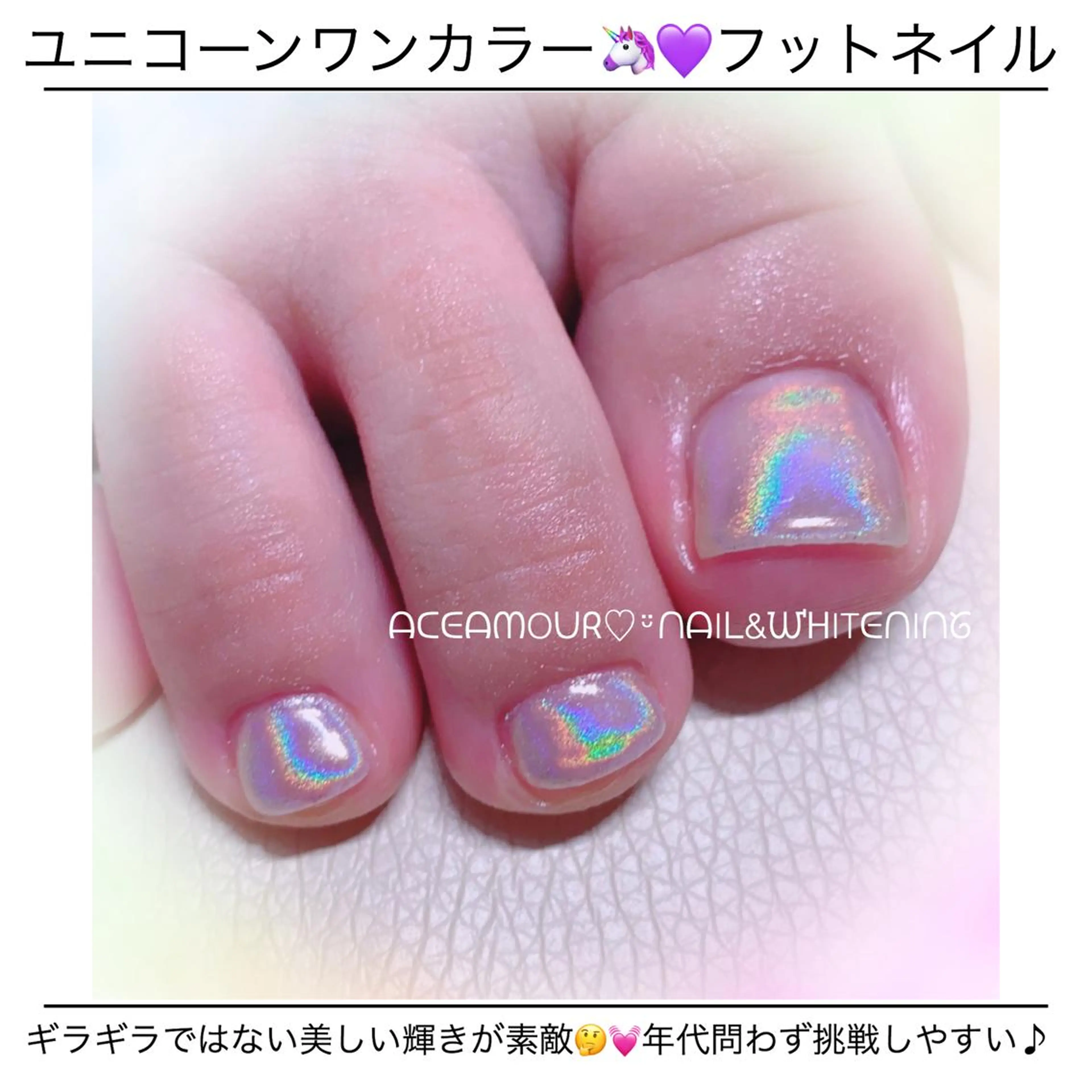 ネイル ネイル/耳つぼ /新ホワイトニングのネイルデザイン